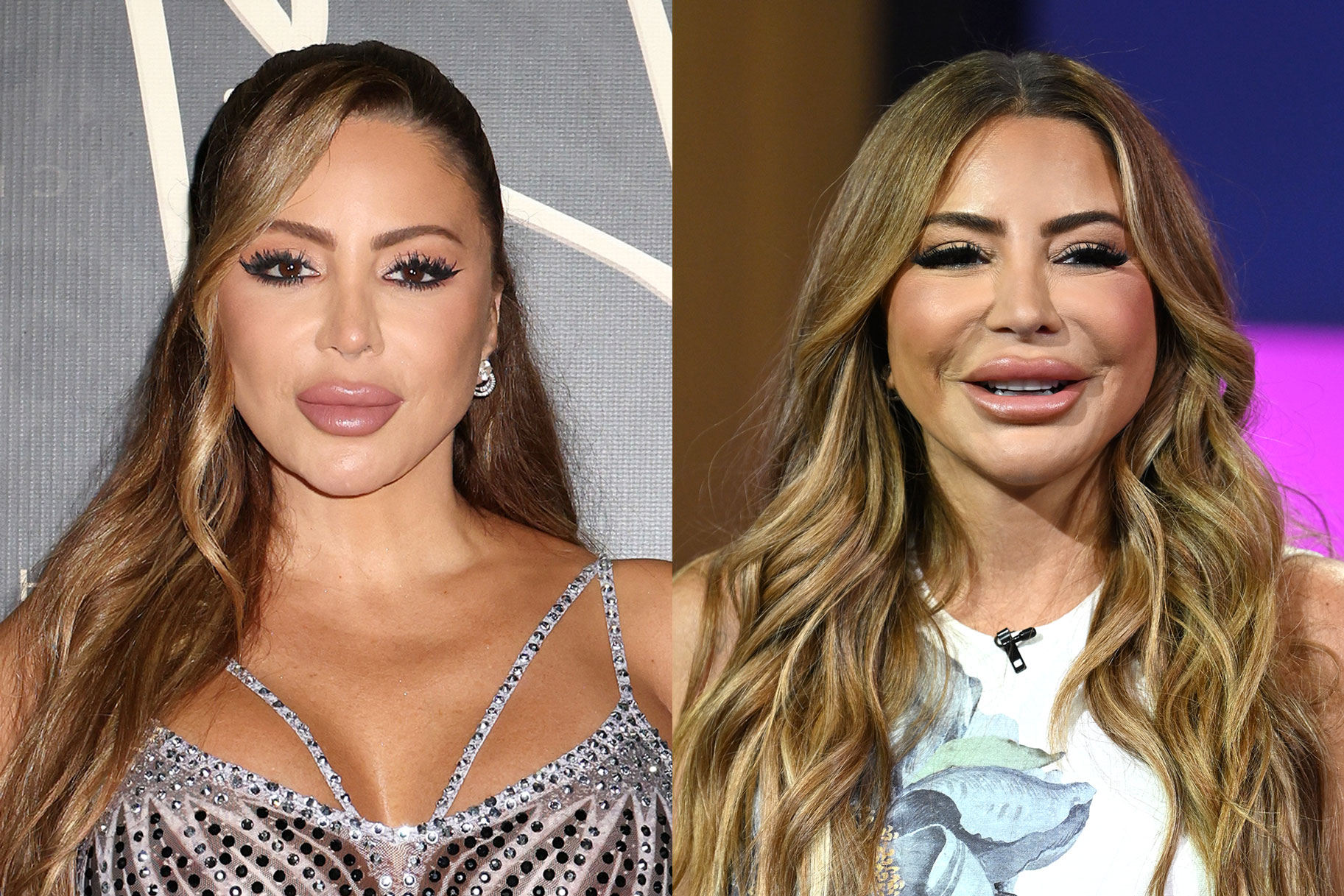 Larsa Pippen Before And After Face Surgery