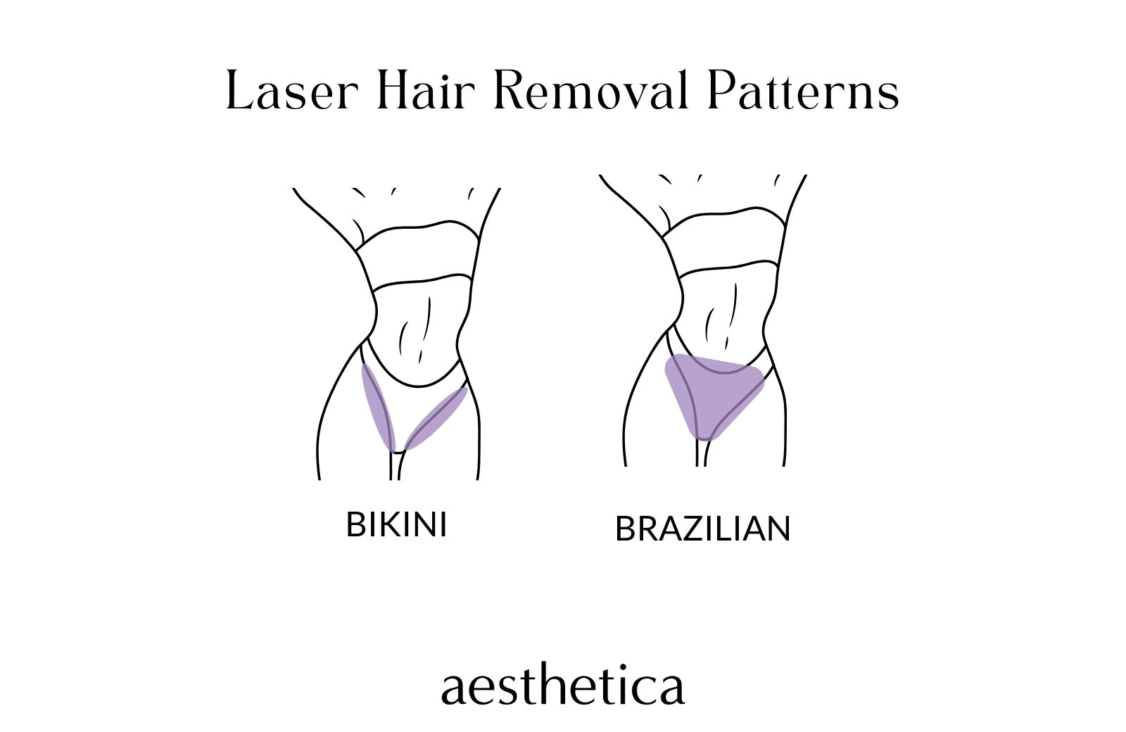 Laser Hair Removal Pubic Area