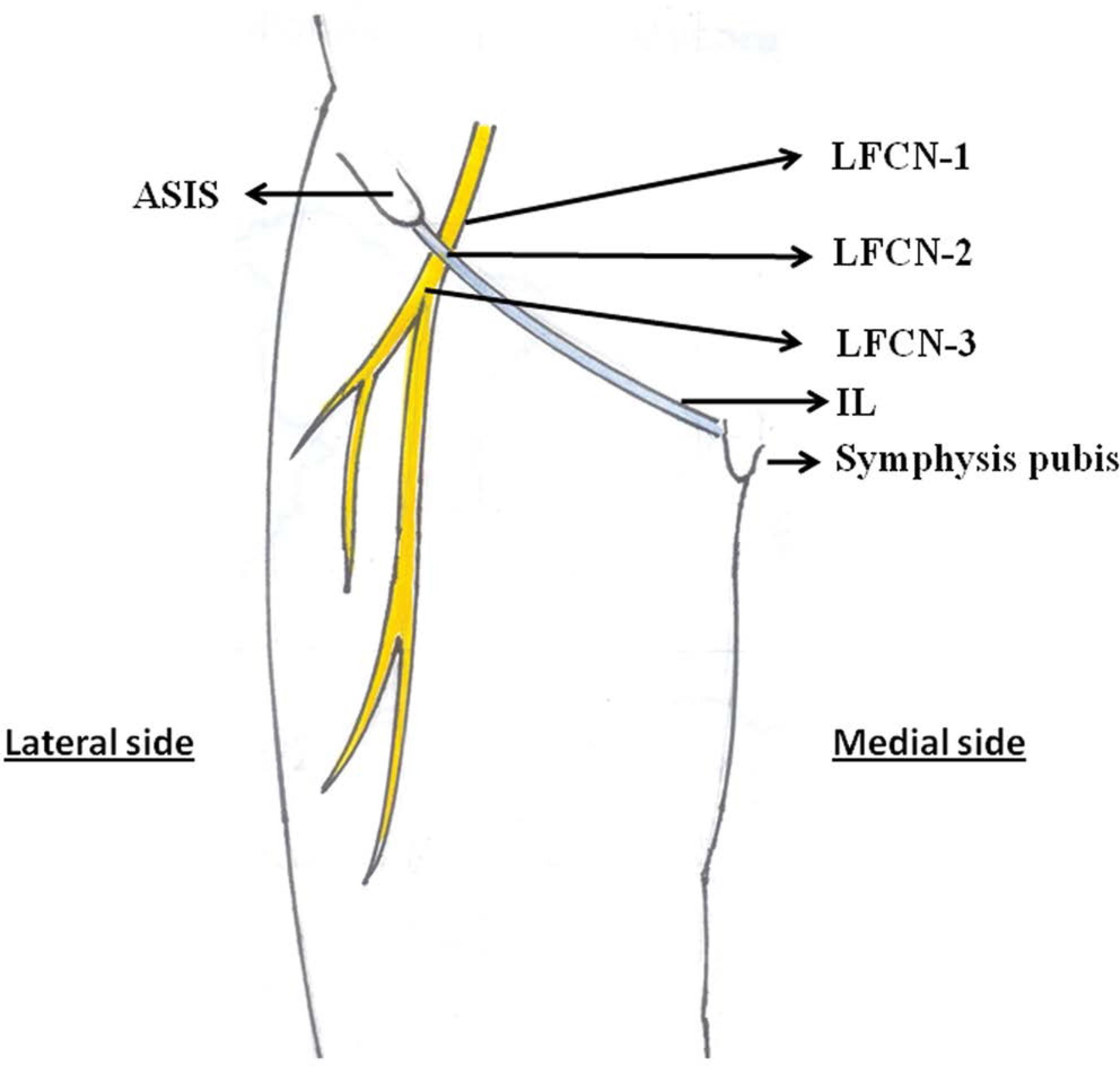 Lateral Cut Nerve Of Thigh