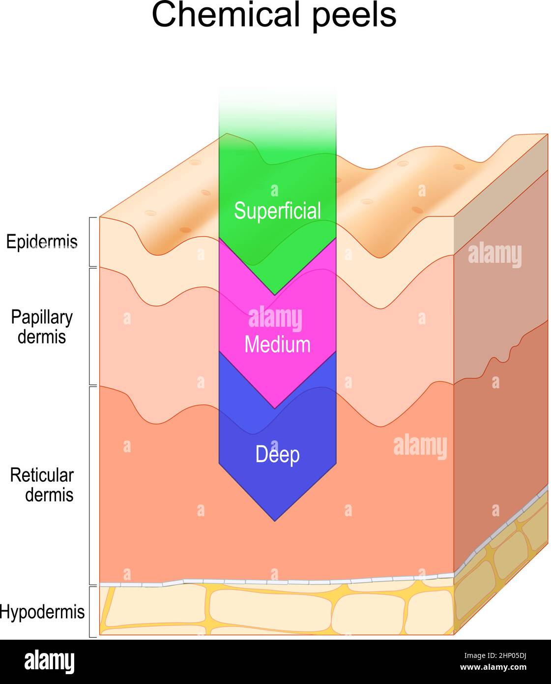 Layers Of Dermis