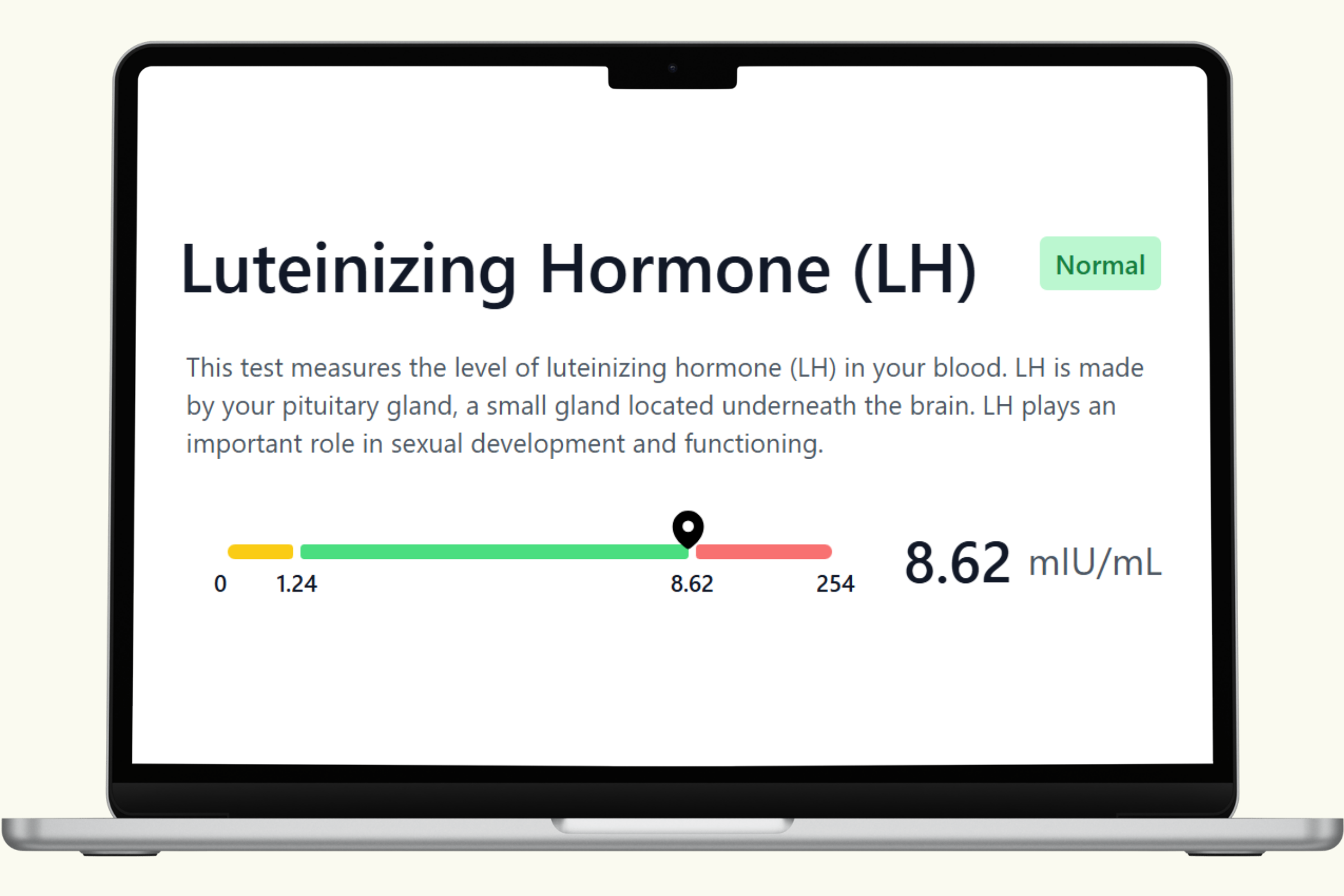 Lh Blood Test