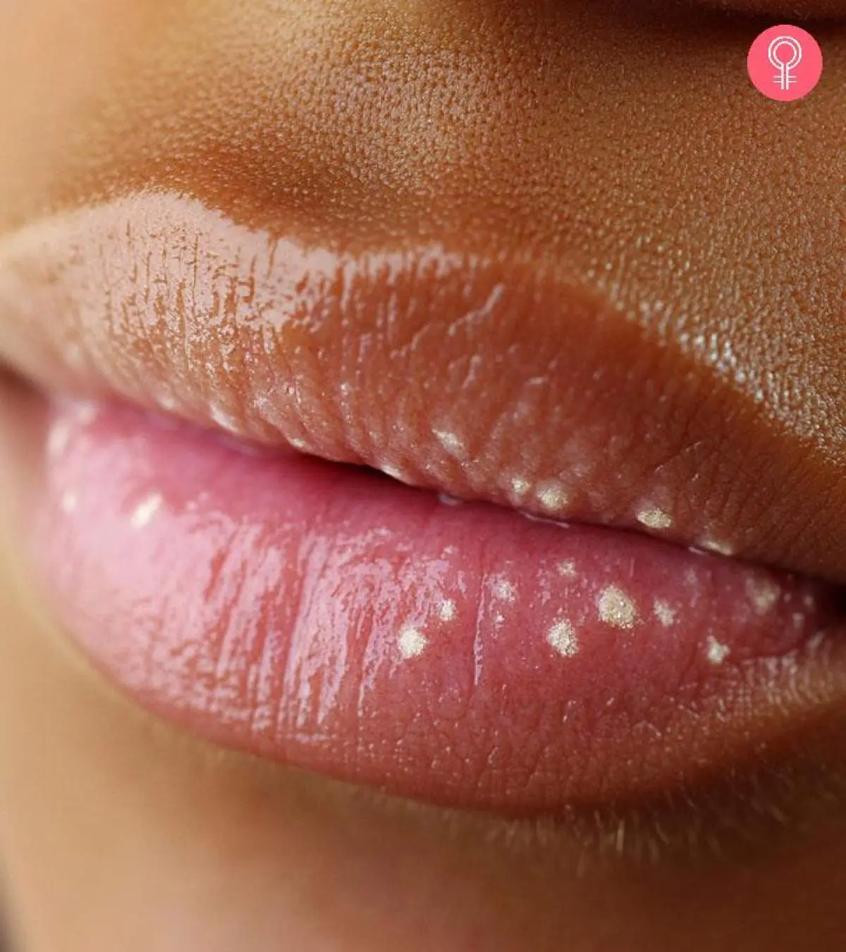 Little White Bumps On Lips
