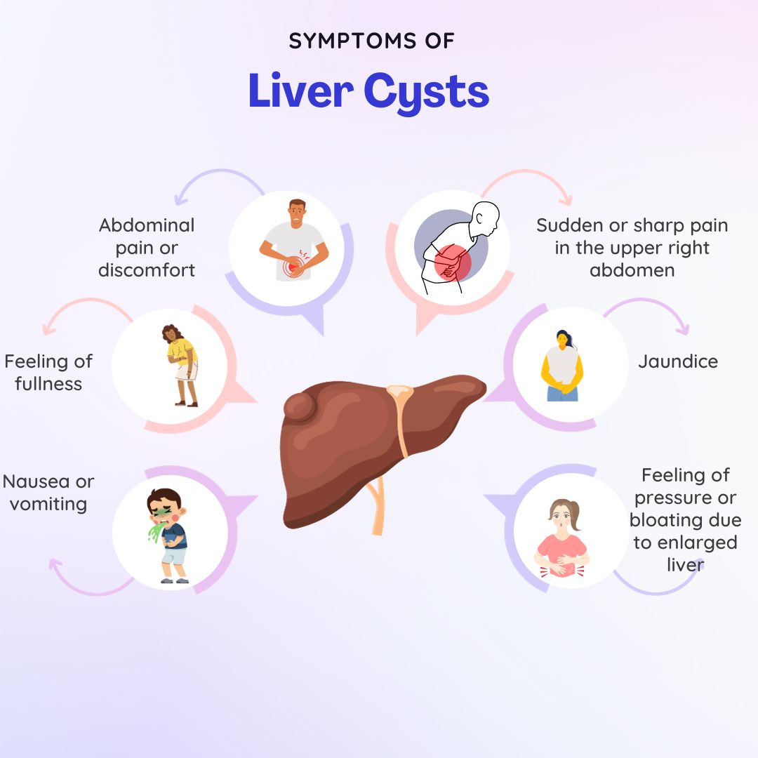 Liver Cyst Symptoms
