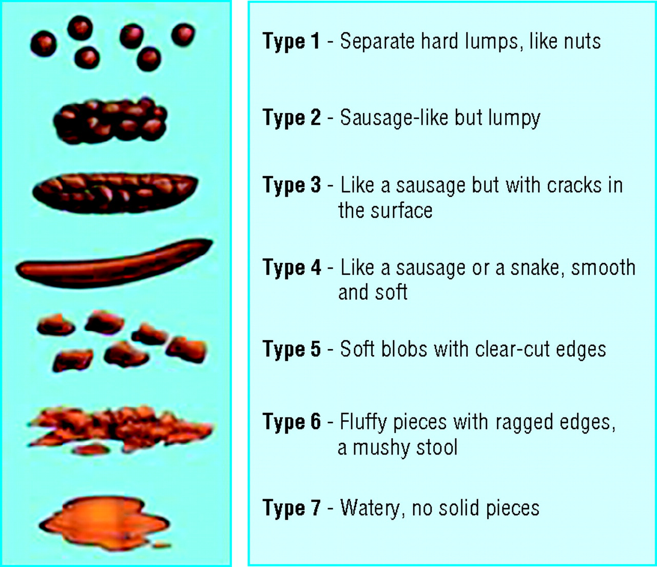 Long Thin Faeces