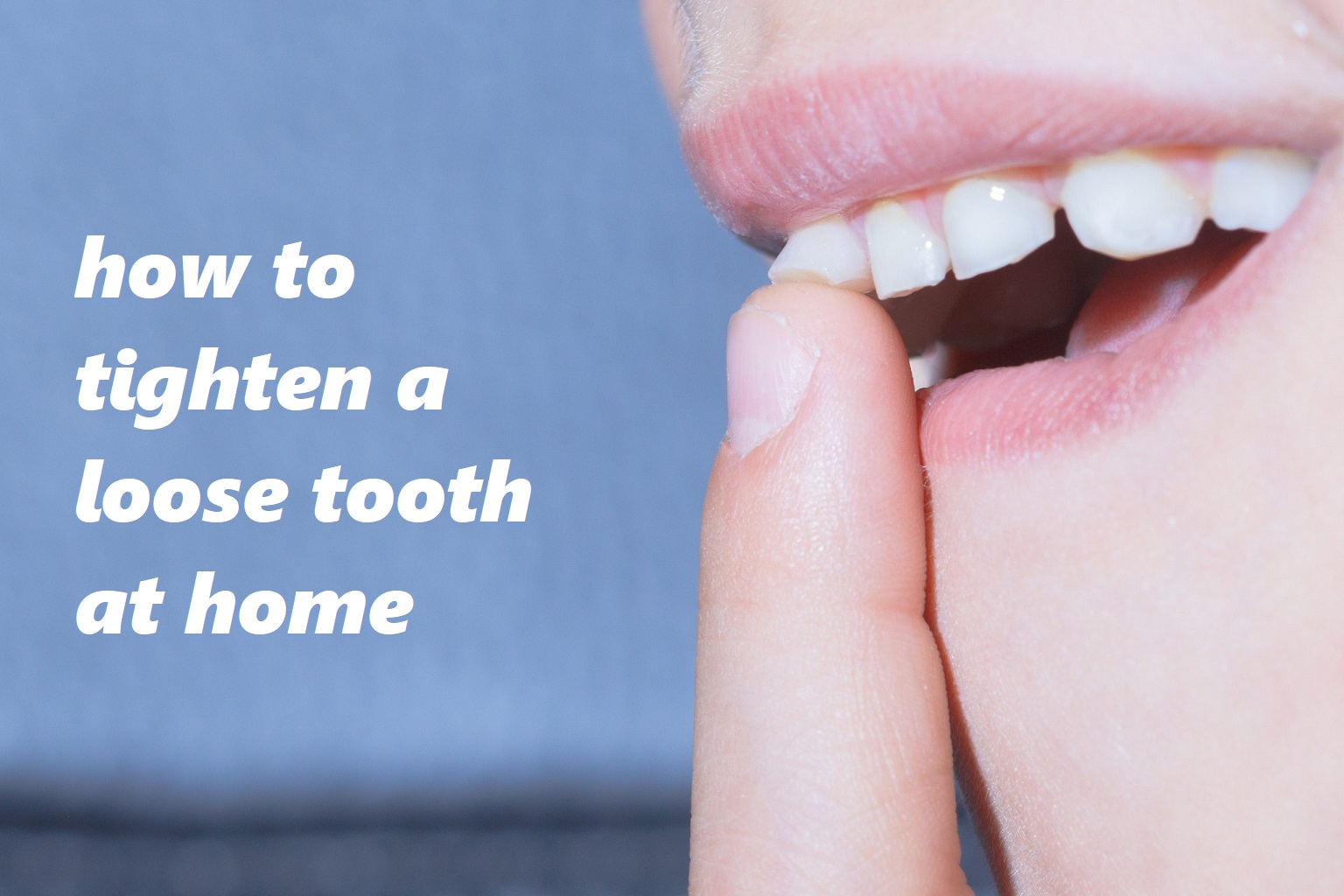 Loose Tooth Dentist