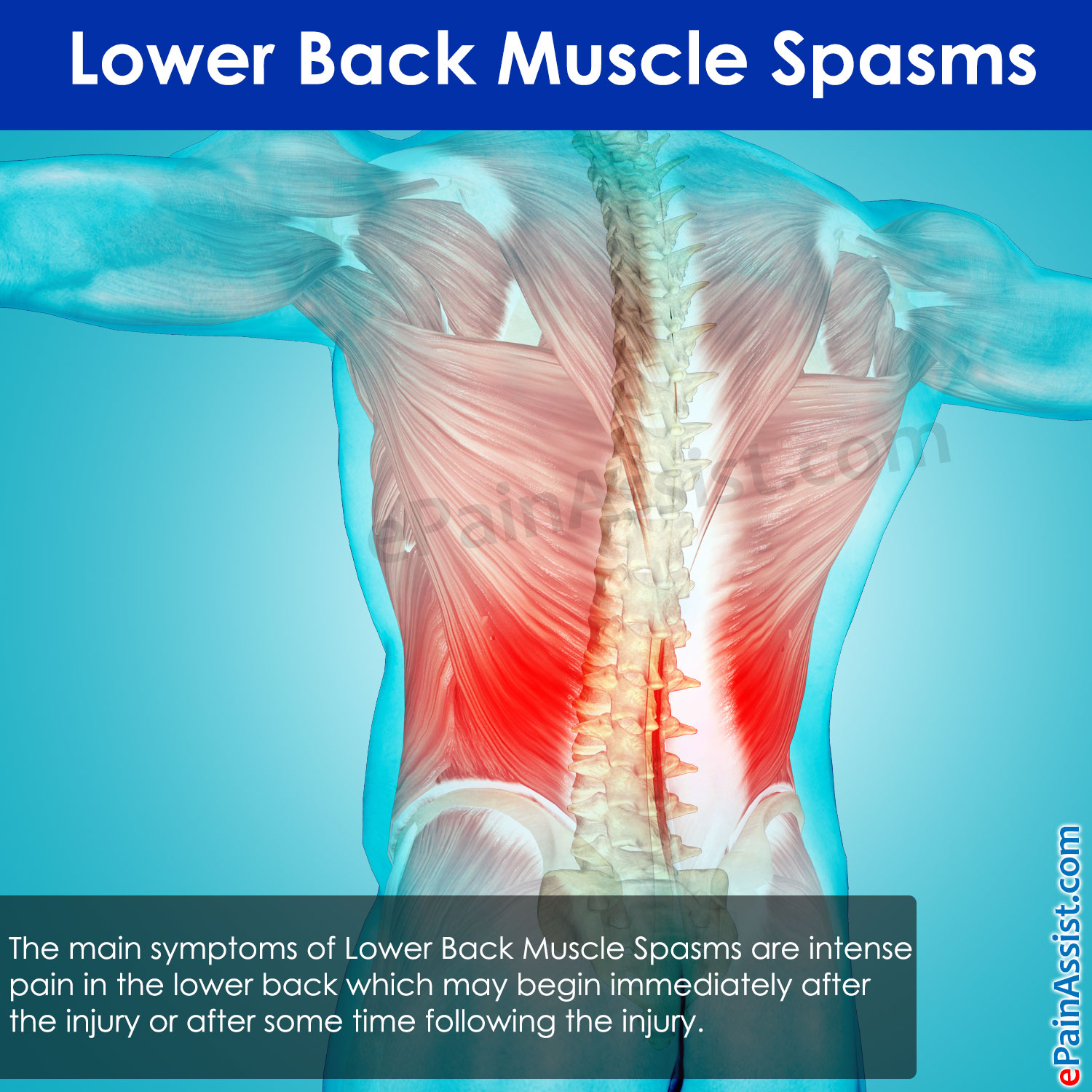 Lower Back Muscle Cramps
