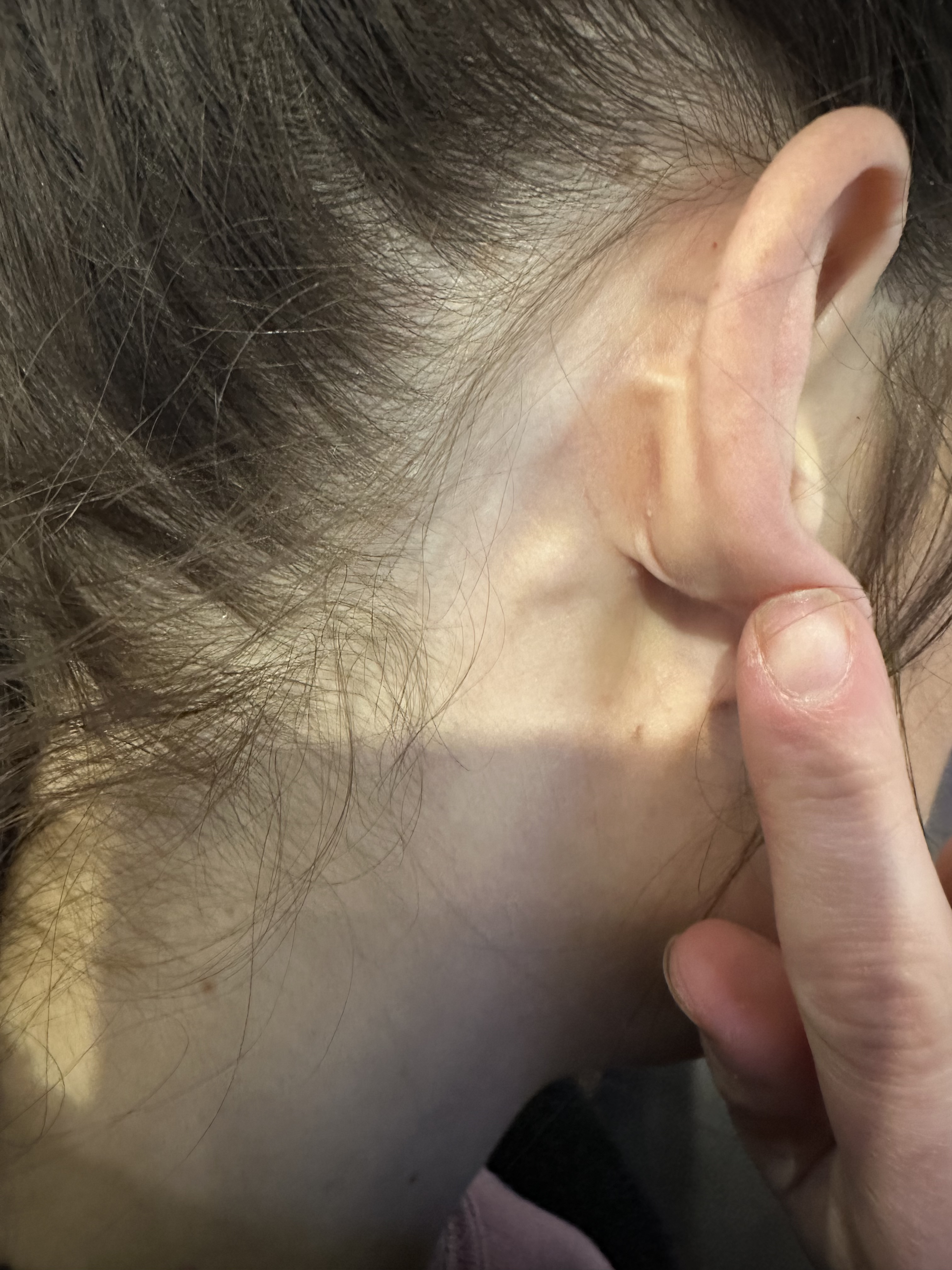 Lumps On Back Of Ears