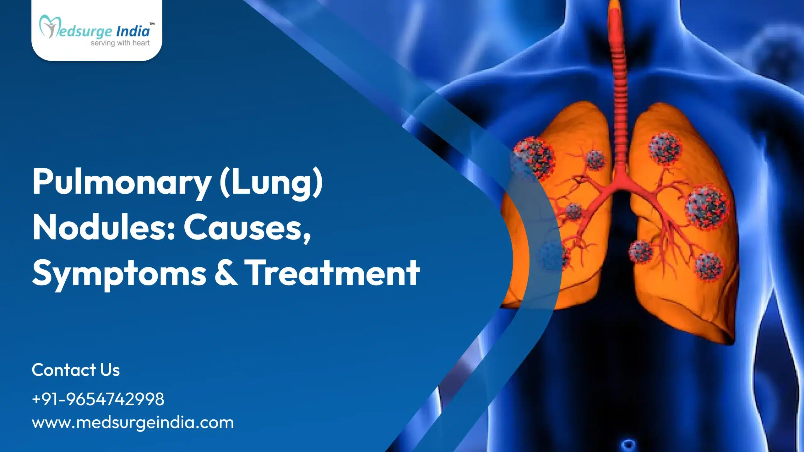 Lung Nodules Causes