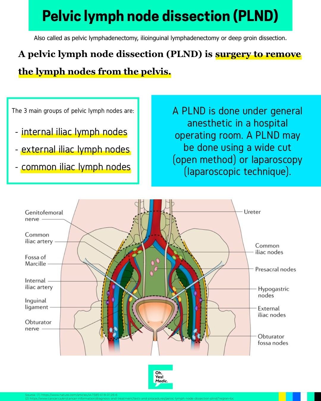 Lymph Node Dissection
