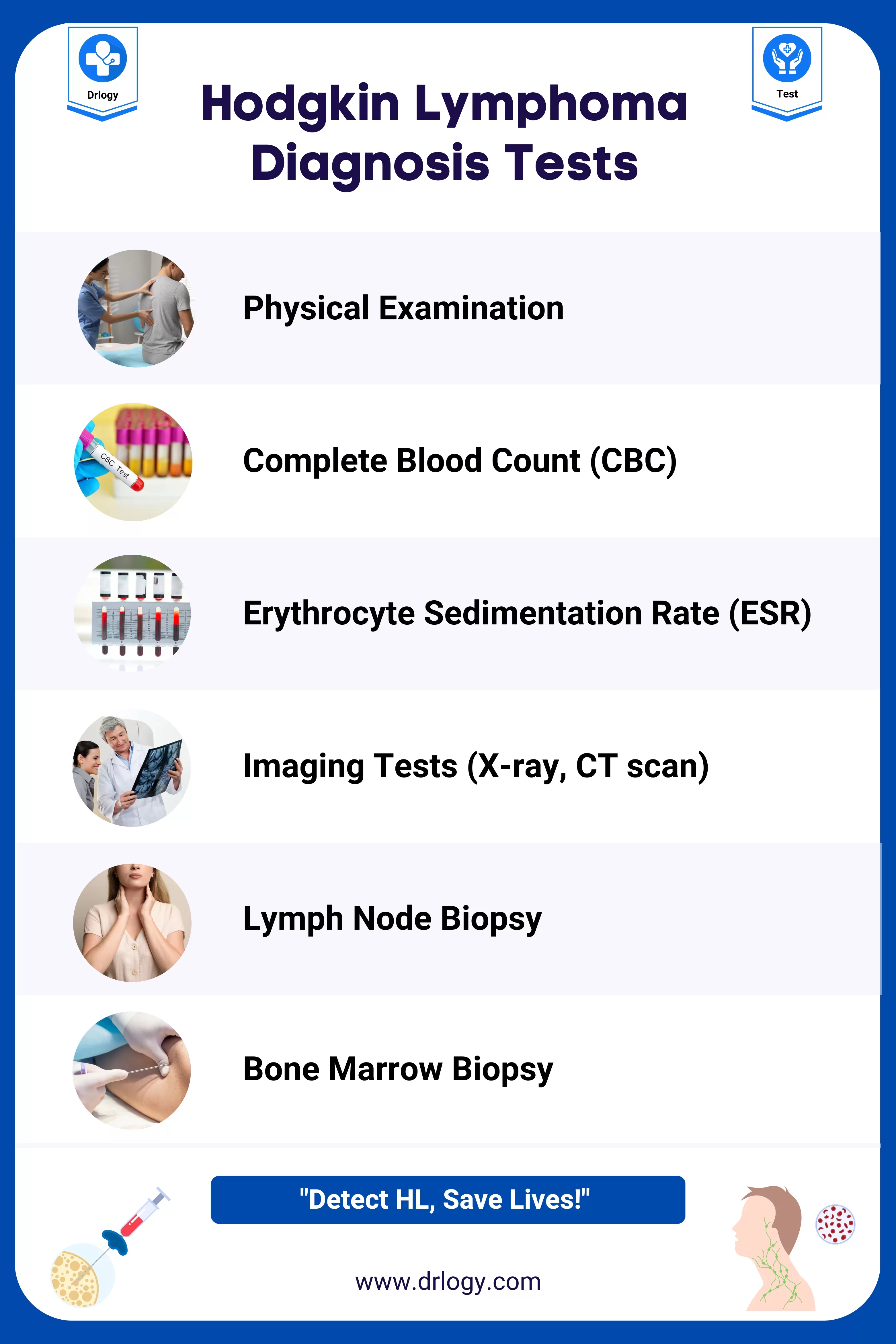 Lymphoma Blood Test
