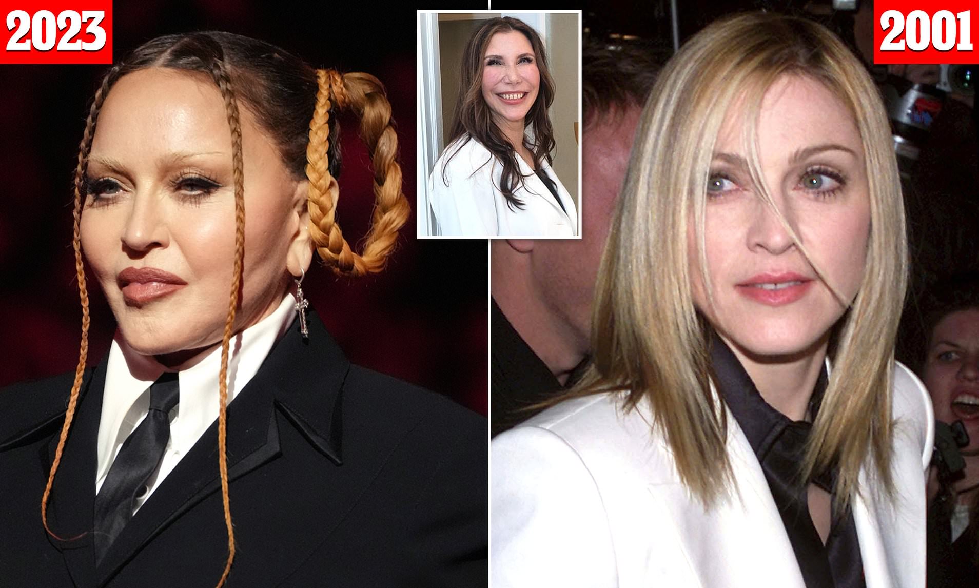 Madonna Face Surgery