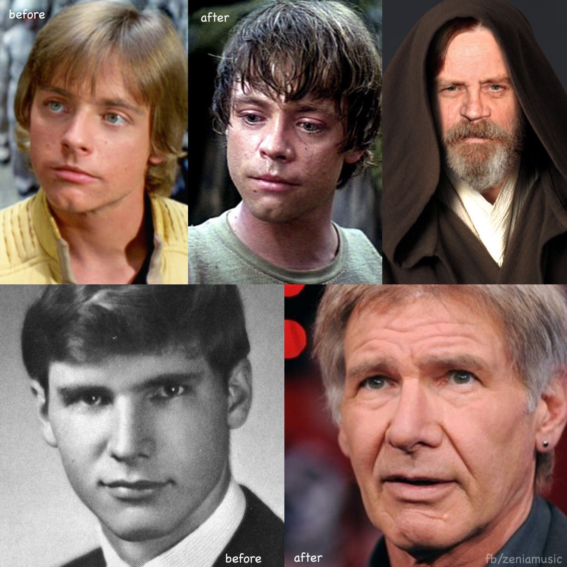 Mark Hamill Face Surgery