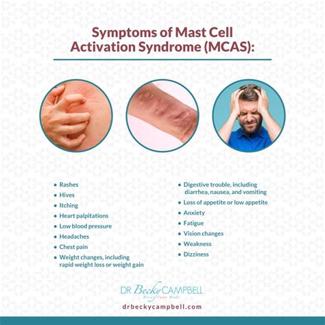 Mast Cell Activation Test