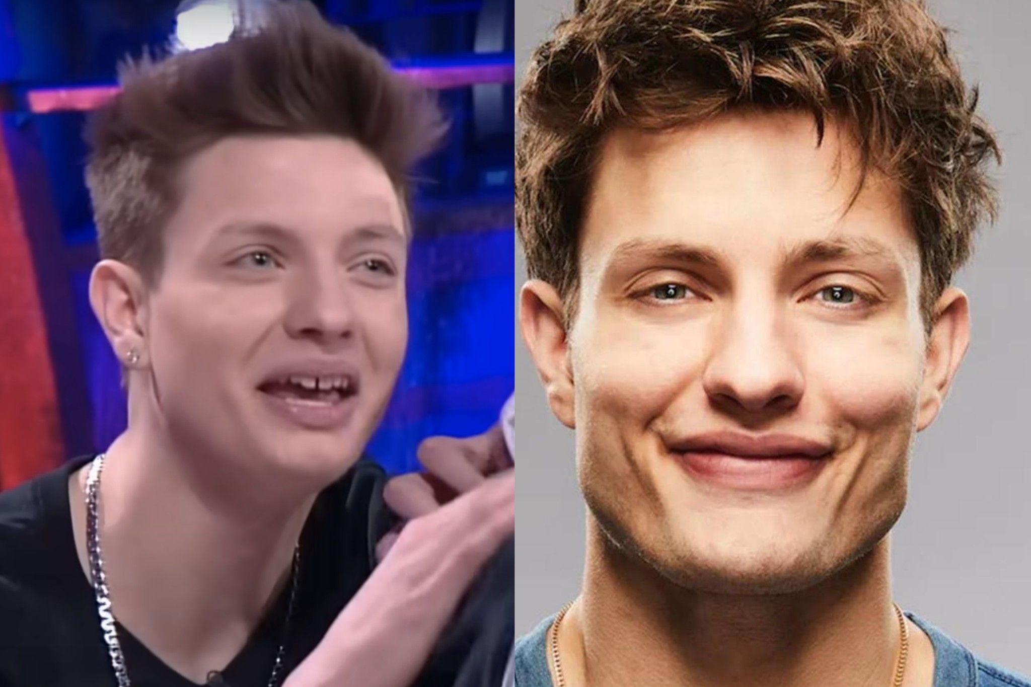 Matt Rife Face Surgery