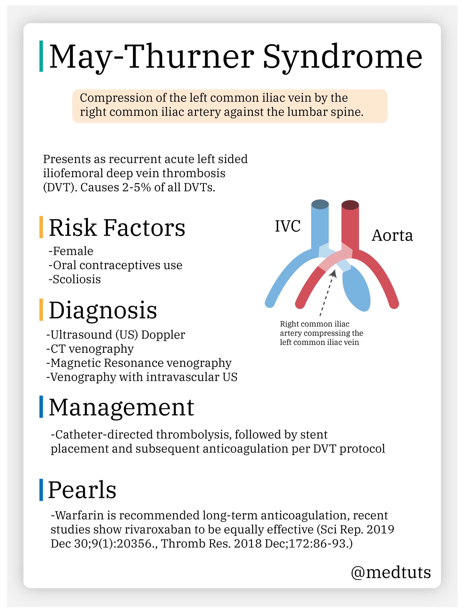 Maythurner Syndrome Life Expectancy