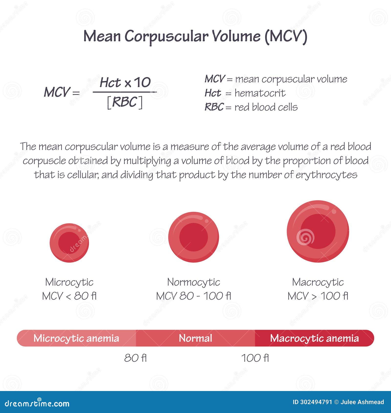 Mcv Low Blood Test