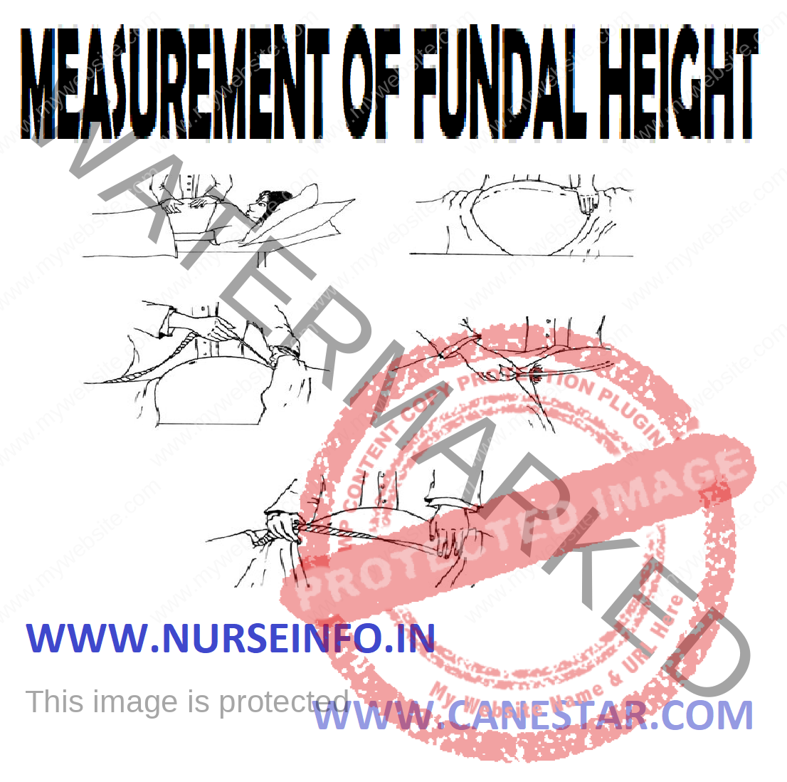 Measurement Of Fundal Height