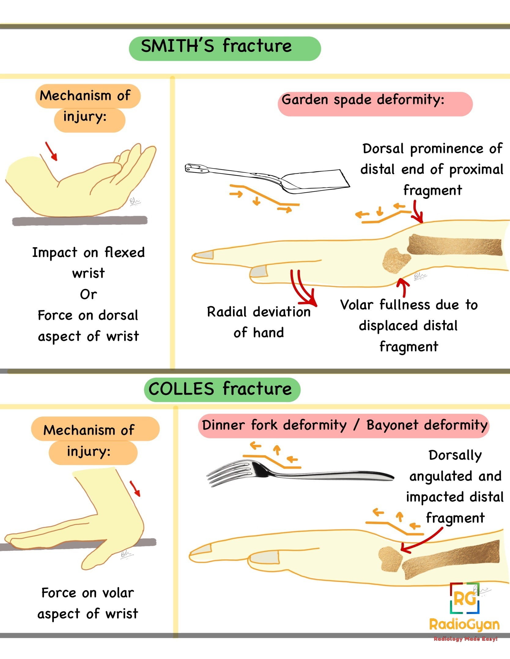 Mechanism Of Injury