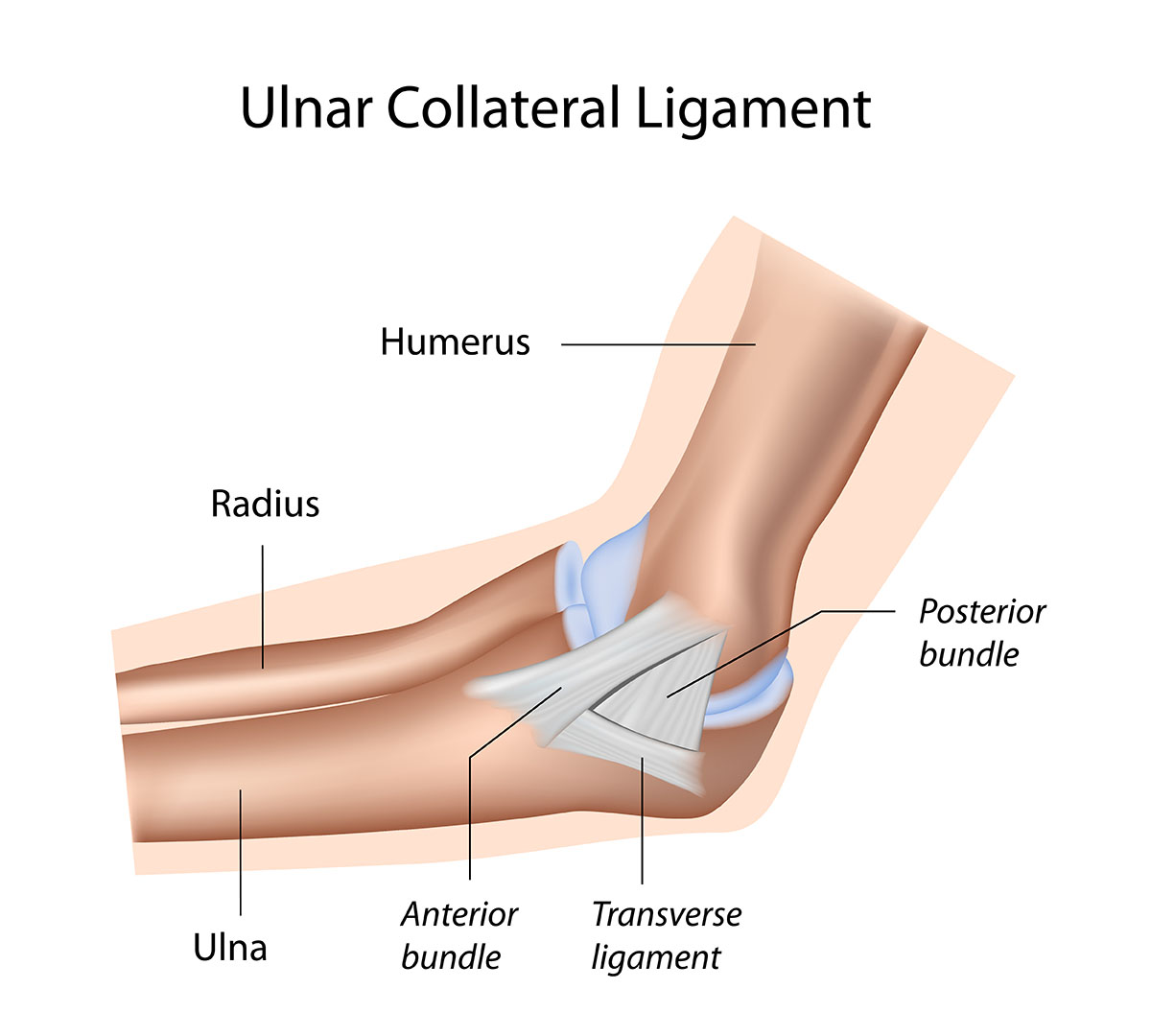 Mechanism Of Ucl Injury