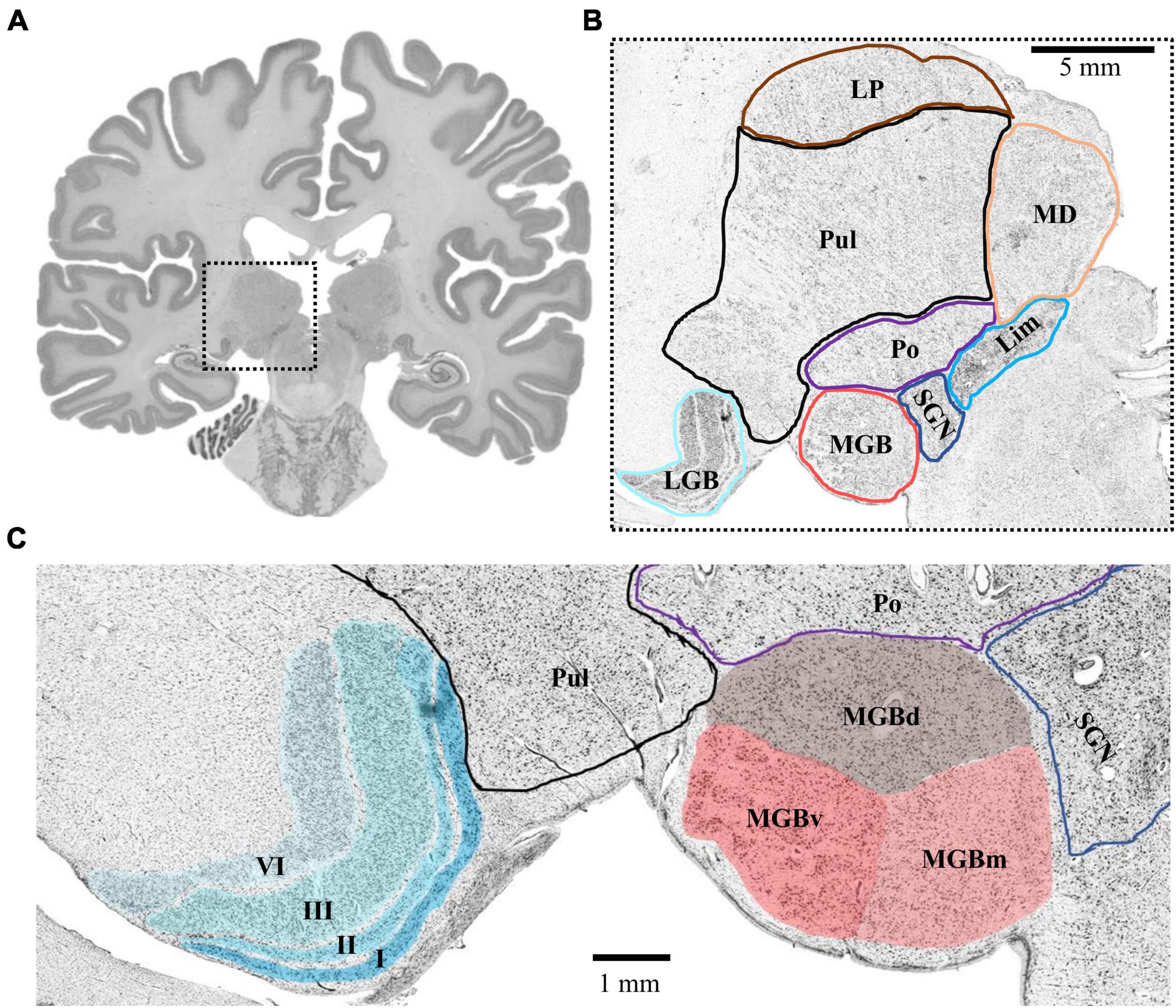 Medial Geniculate Nucleus