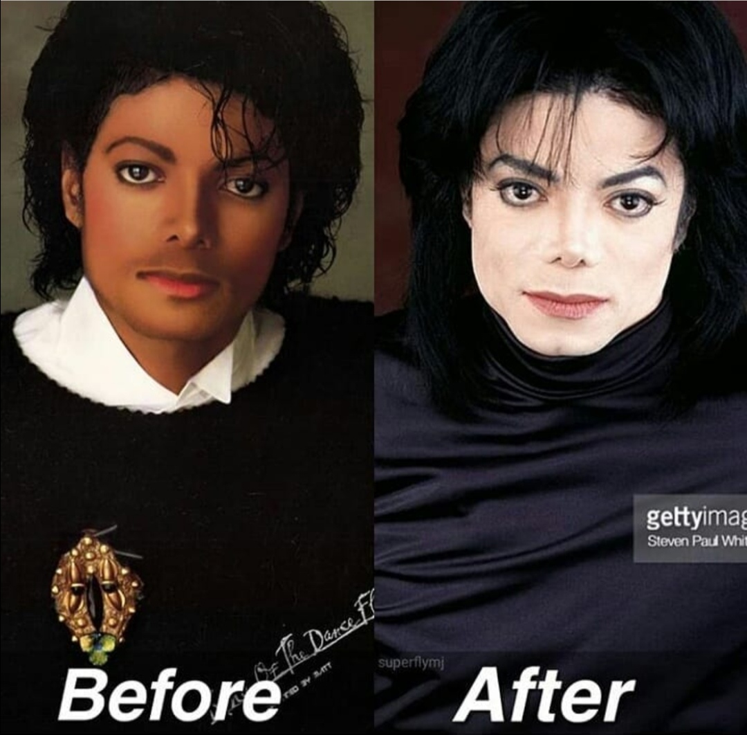 Michael Jackson Before Face Surgery