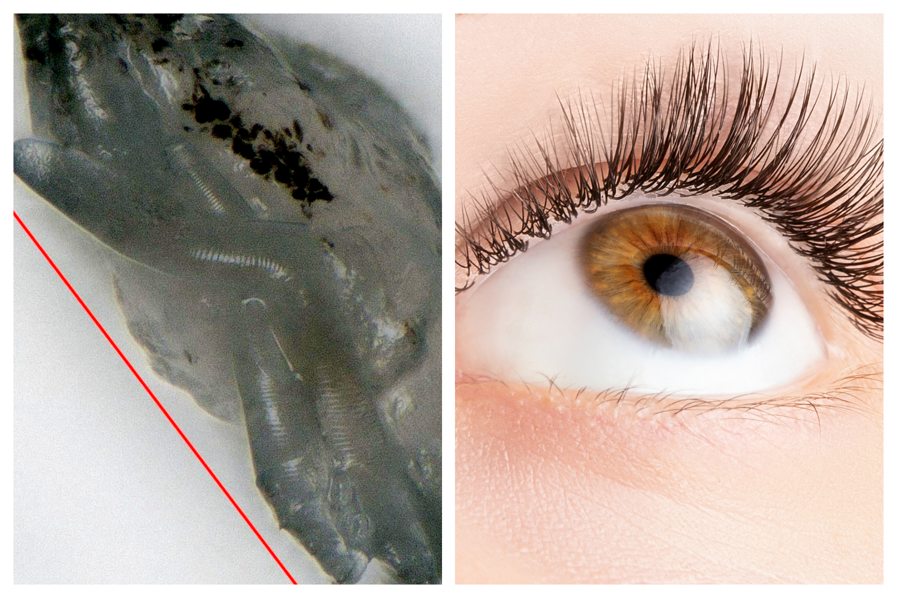 Mites On Eyelashes