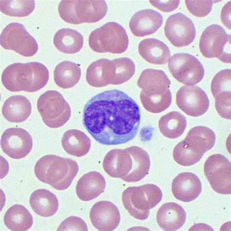 Monocytes Blood Test