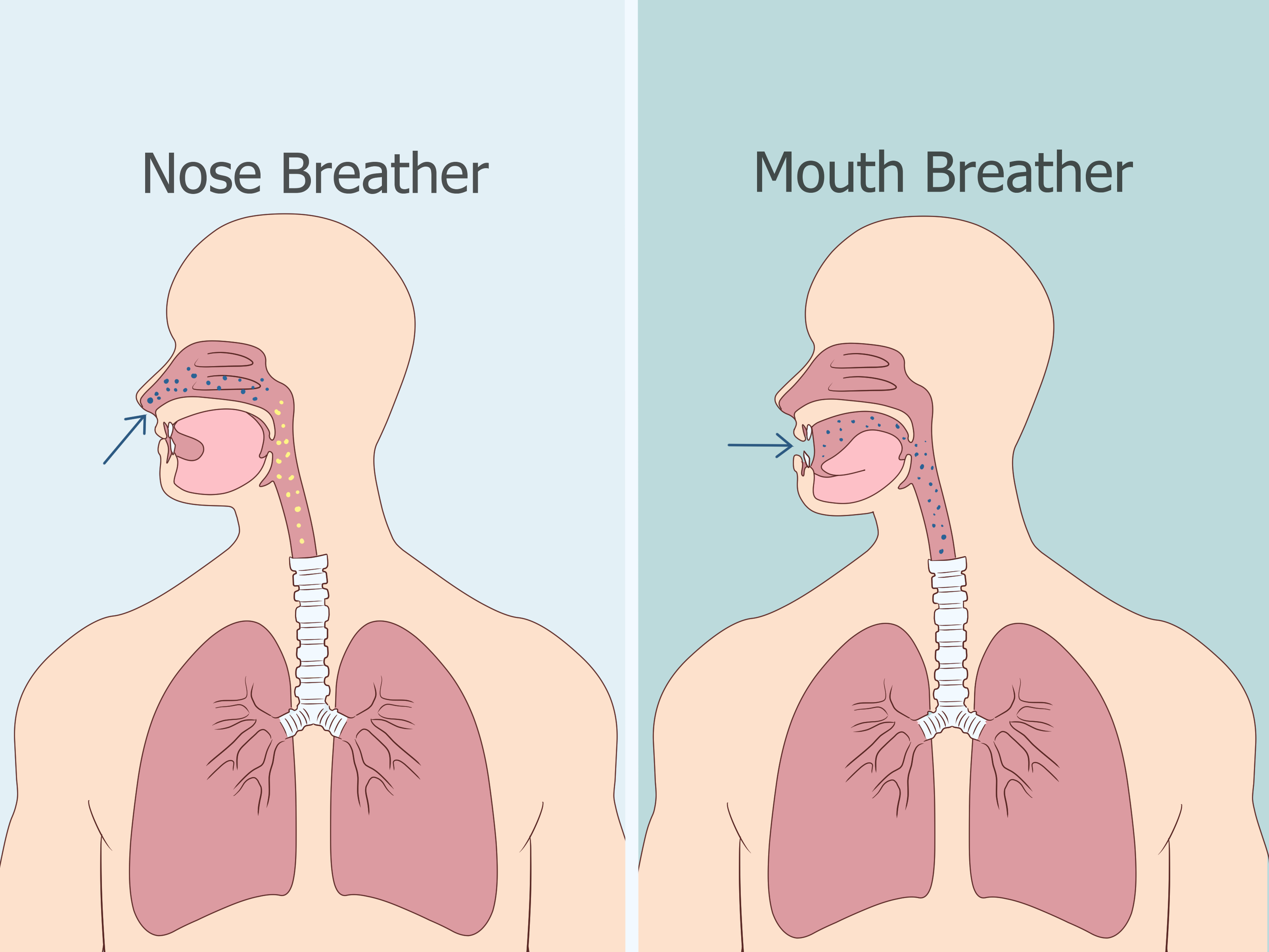 Mouth Breathing Face