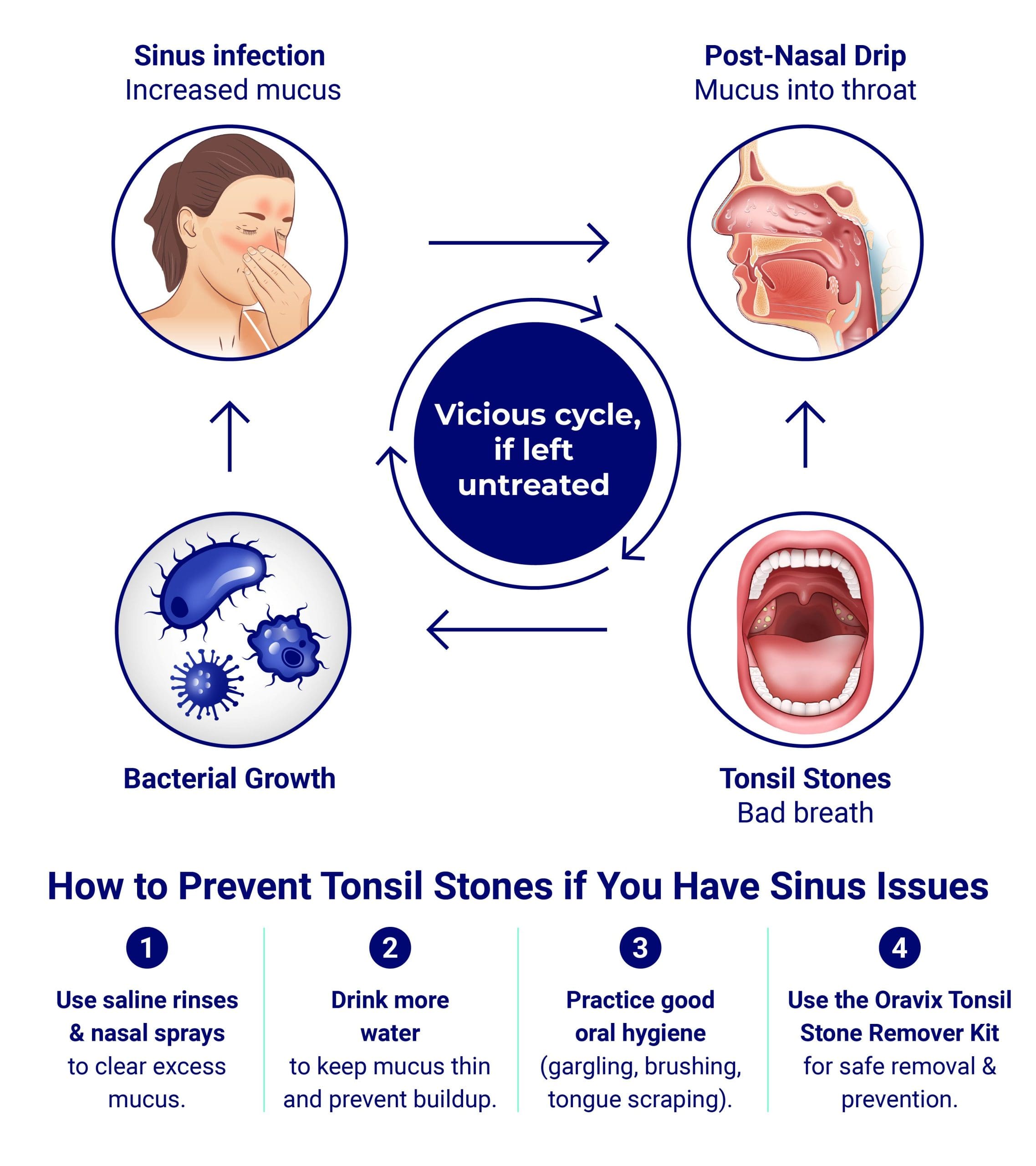Nasal Drip Sore Throat
