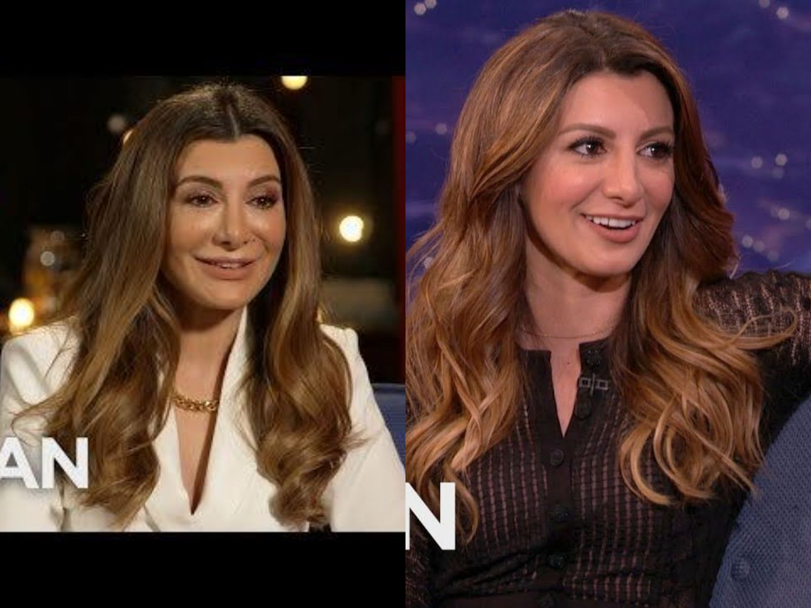 Nasim Pedrad Face Surgery