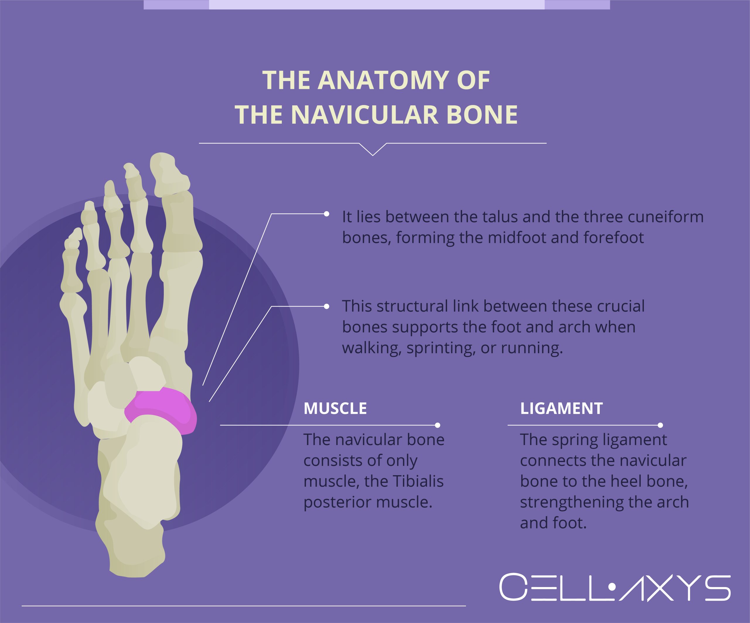 Navicular Bone Pain
