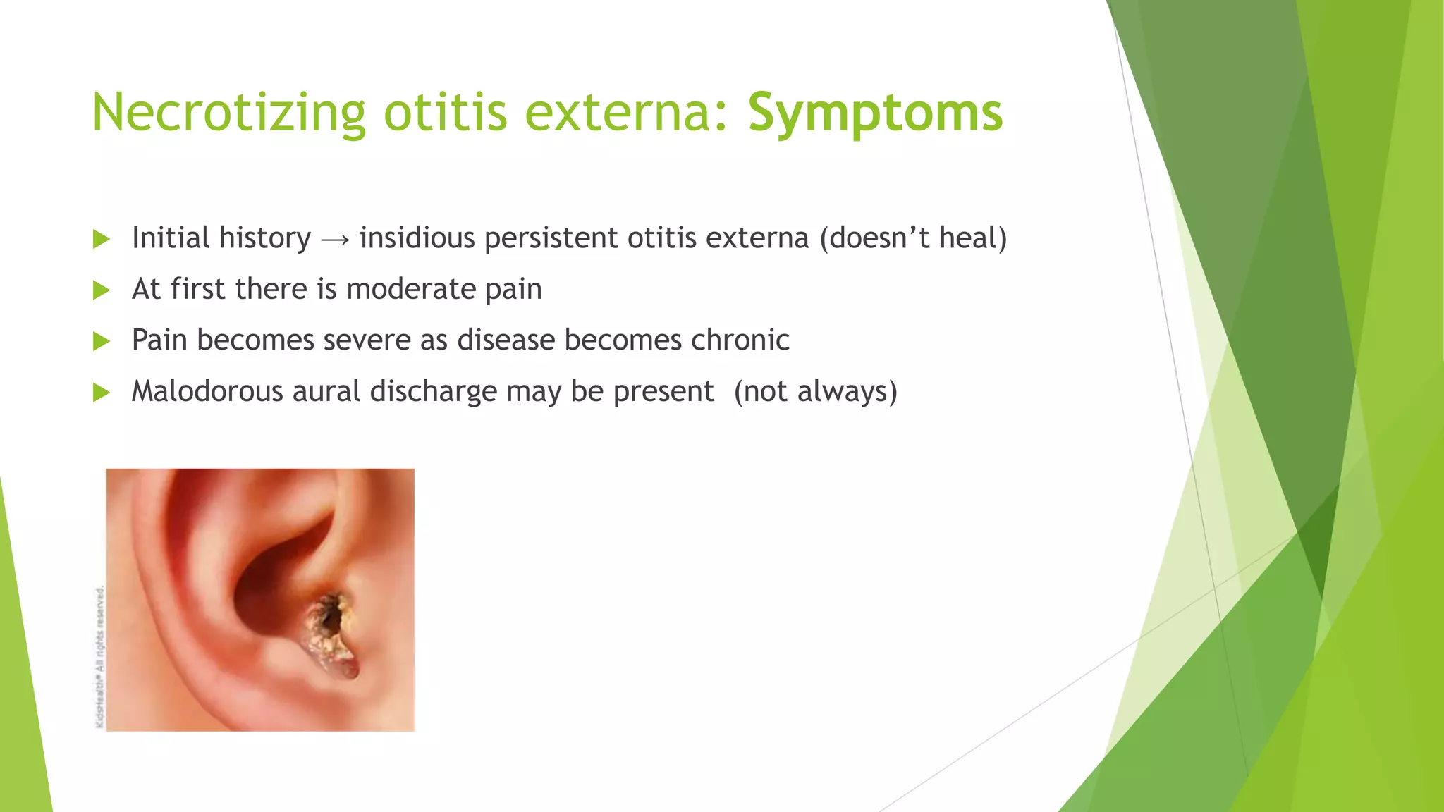 Necrotizing Otitis Externa