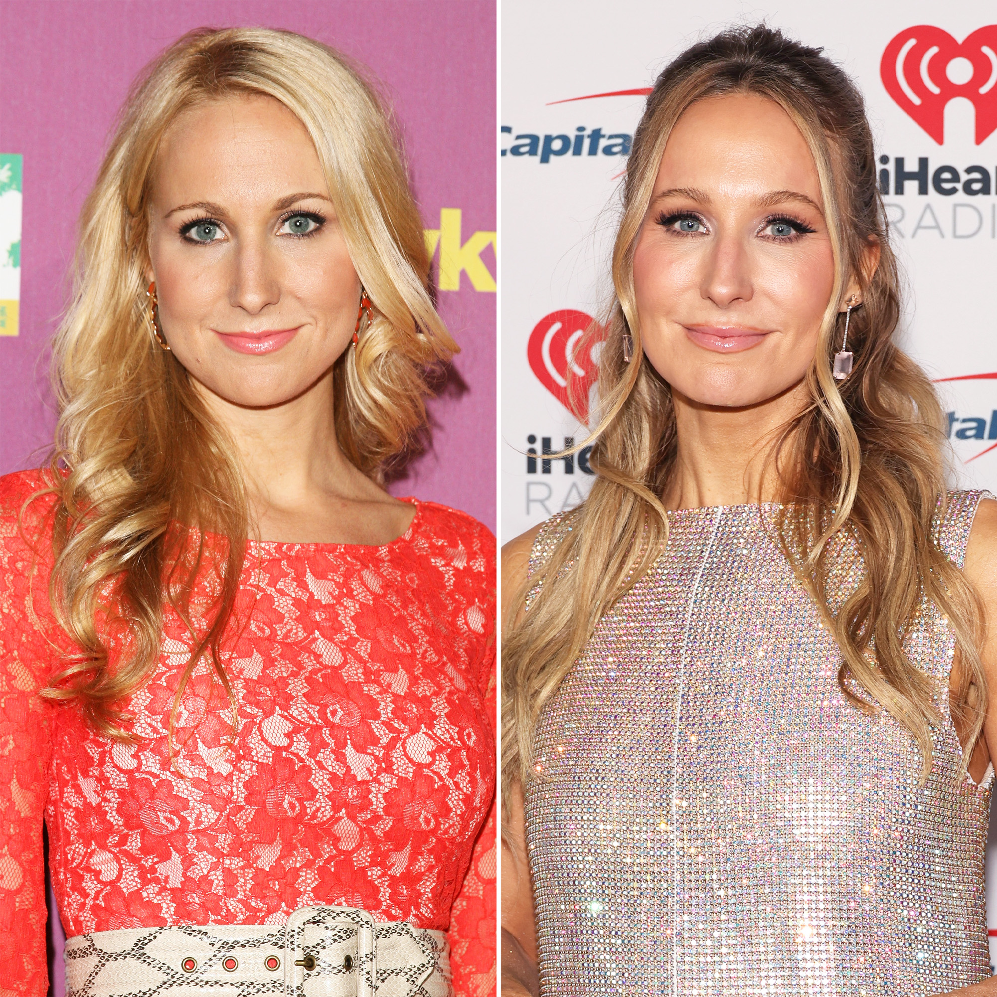 Nikki Glaser Face Surgery