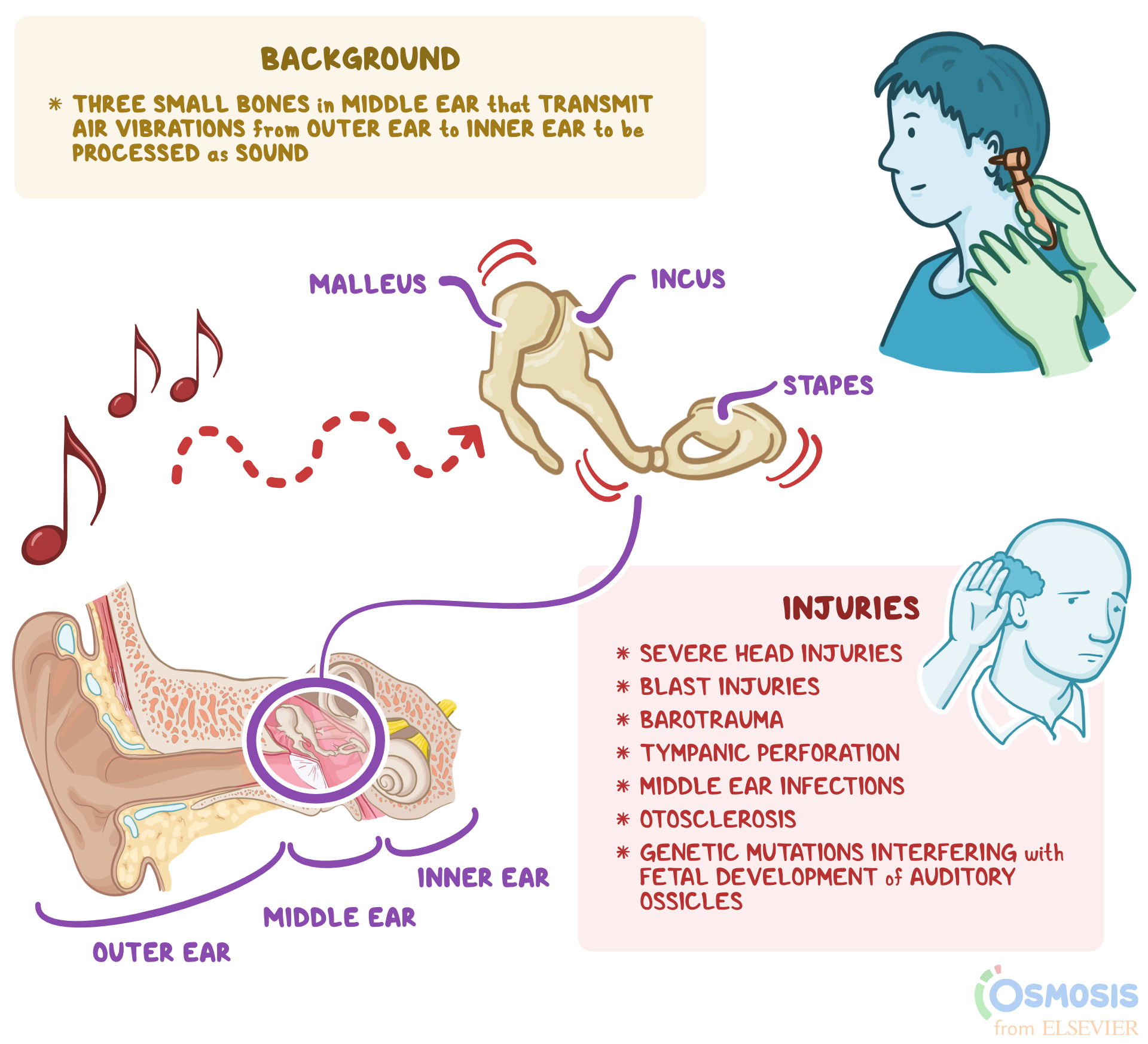 Noise In Ears Not Tinnitus