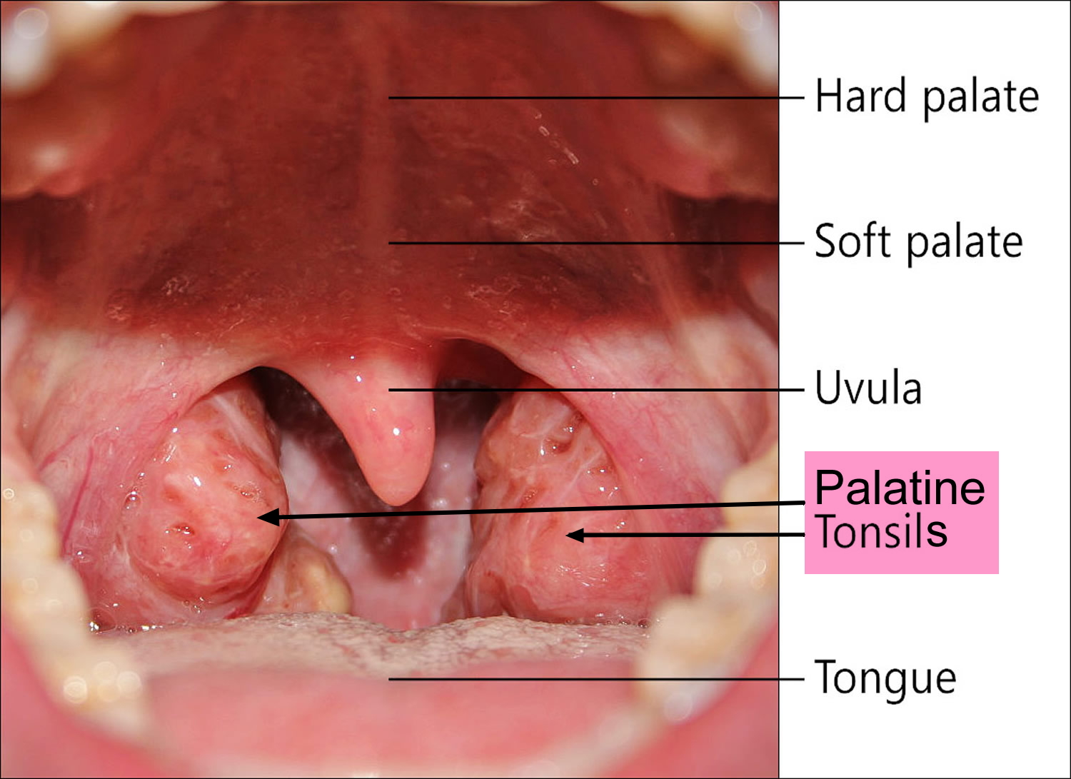 Normal Image Of Throat