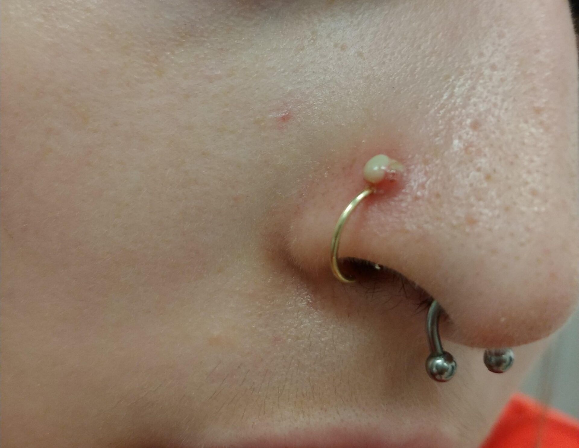 Nose Piercing Bump
