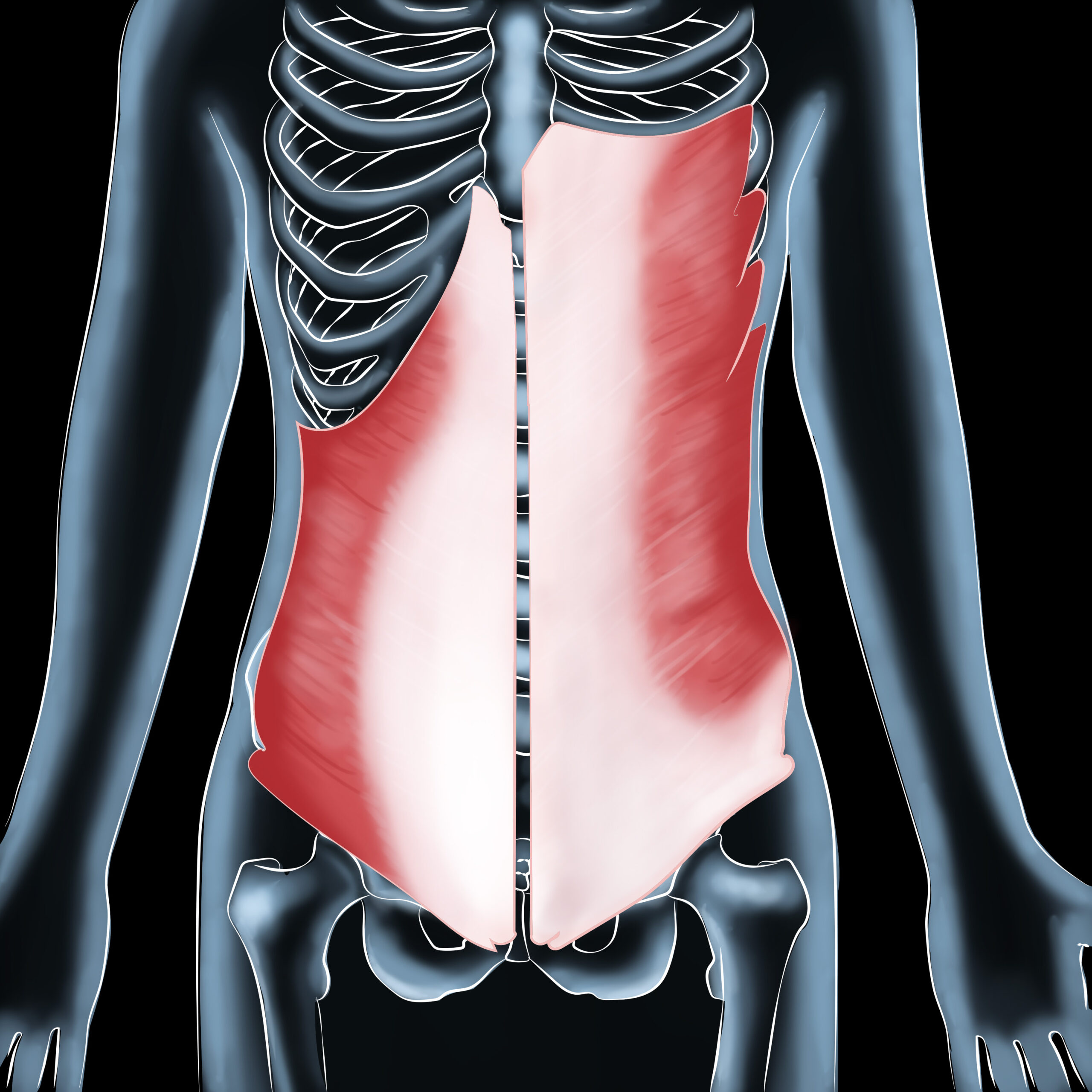Oblique Abdominal Strain