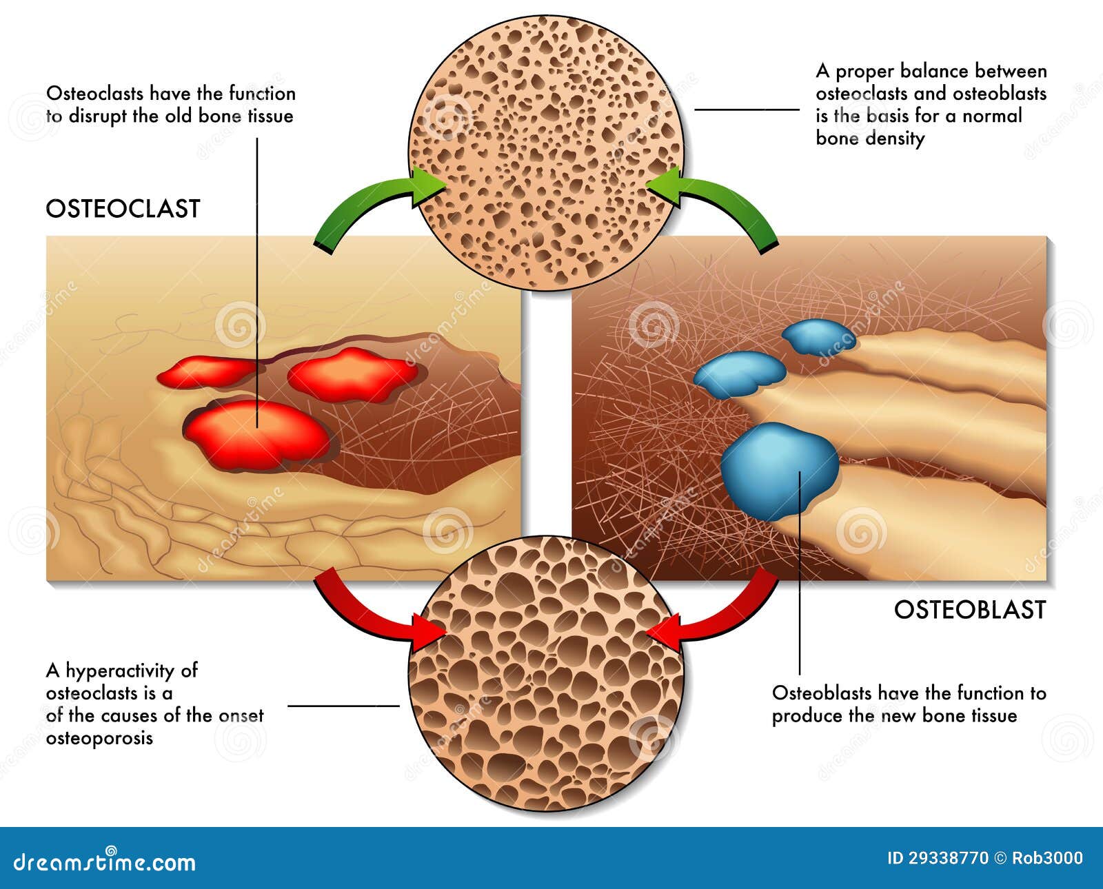 Osteoclasts Vs Osteoblasts