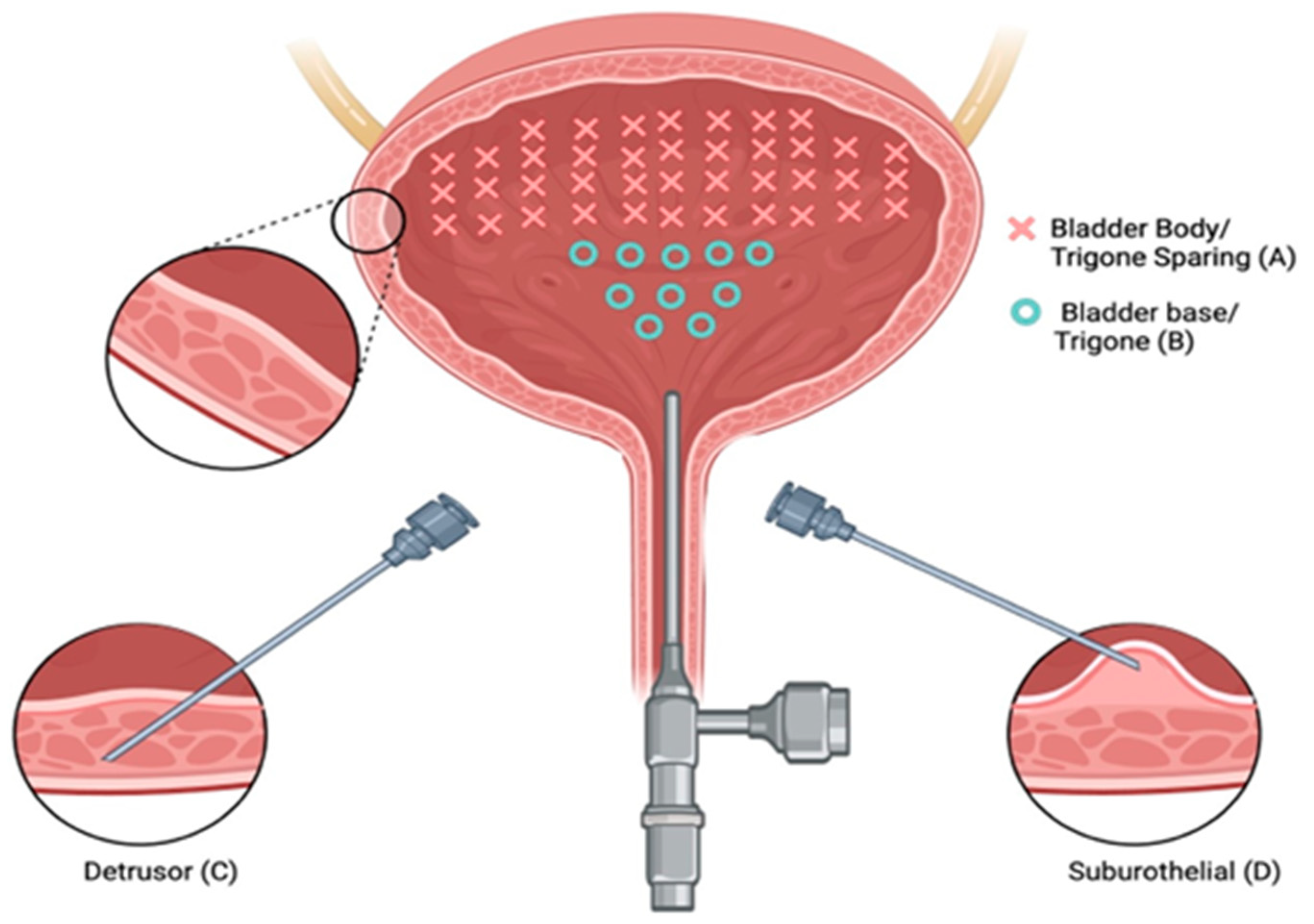 Overactive Bladder Therapies