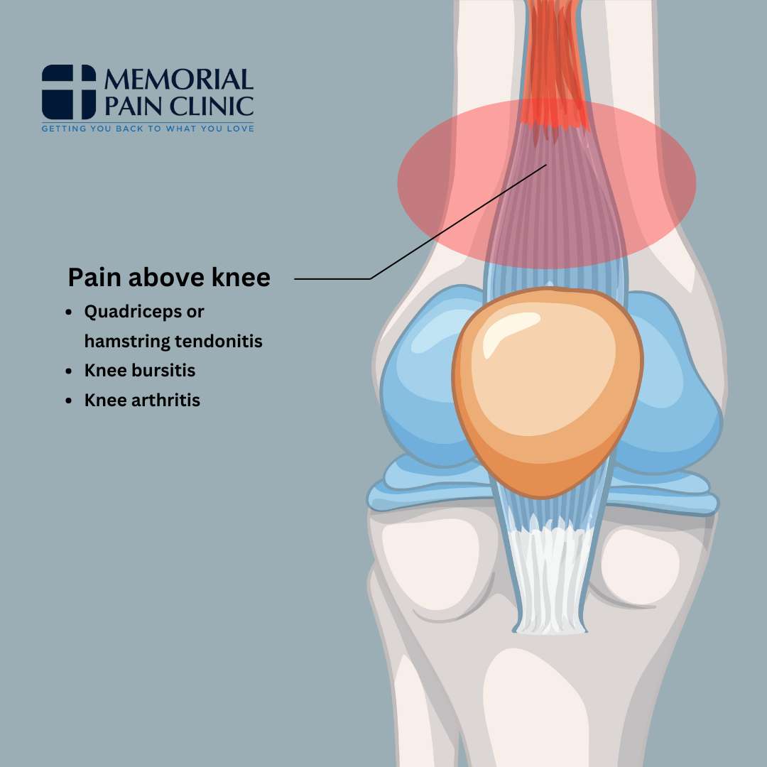 Pain Above Kneecap