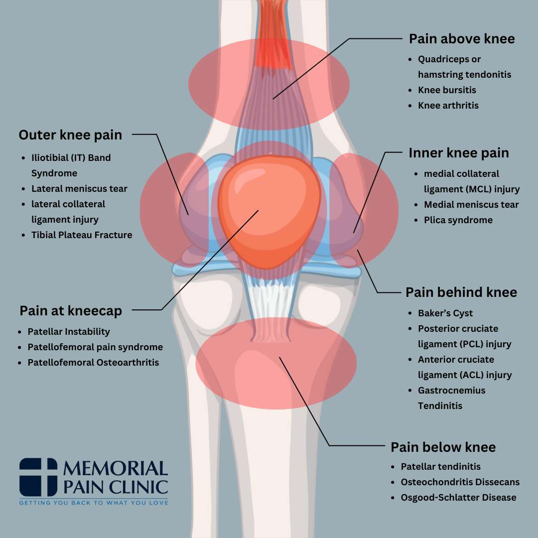 Pain Below Kneecap