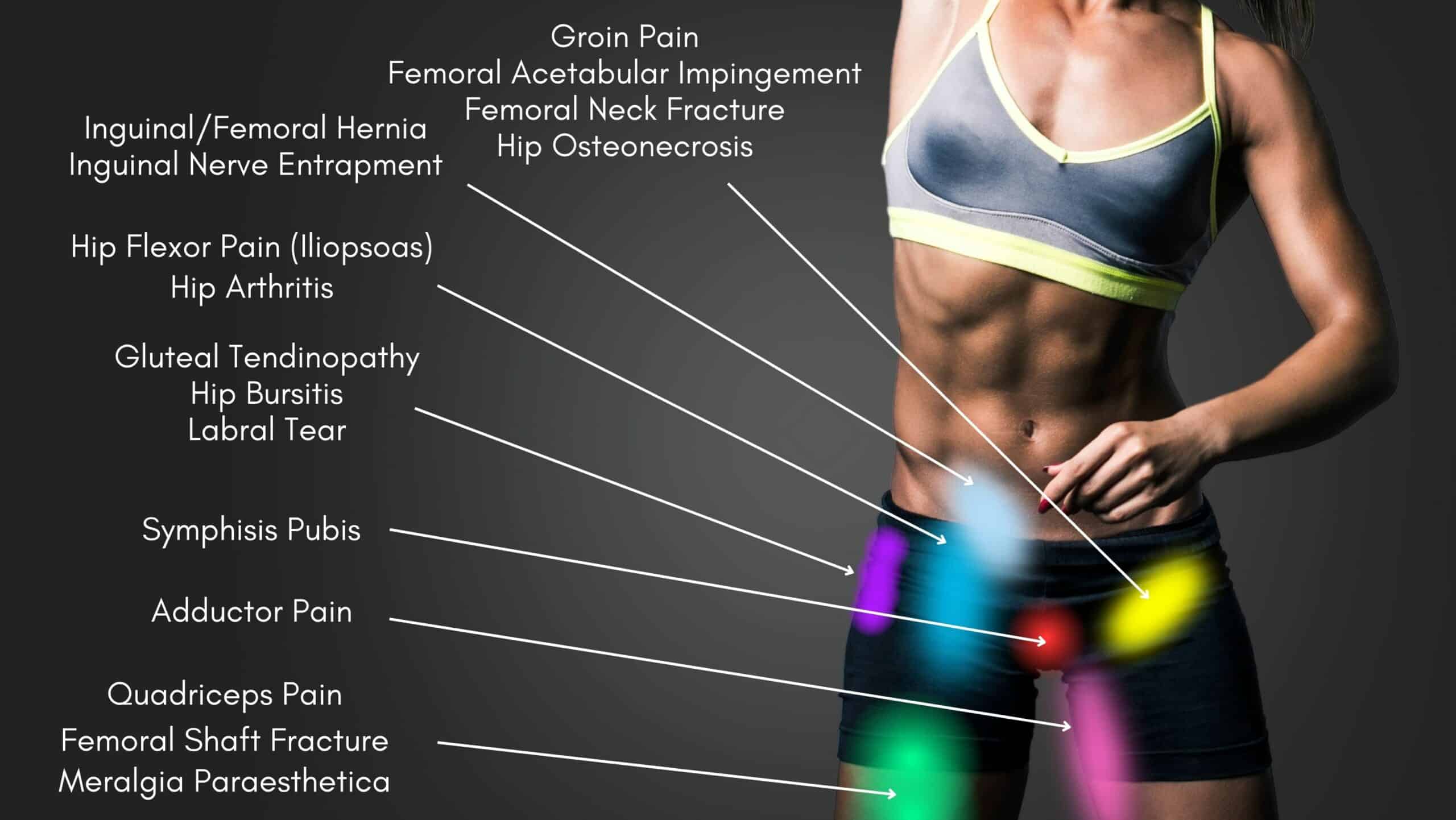 Pain In Groin Area Female