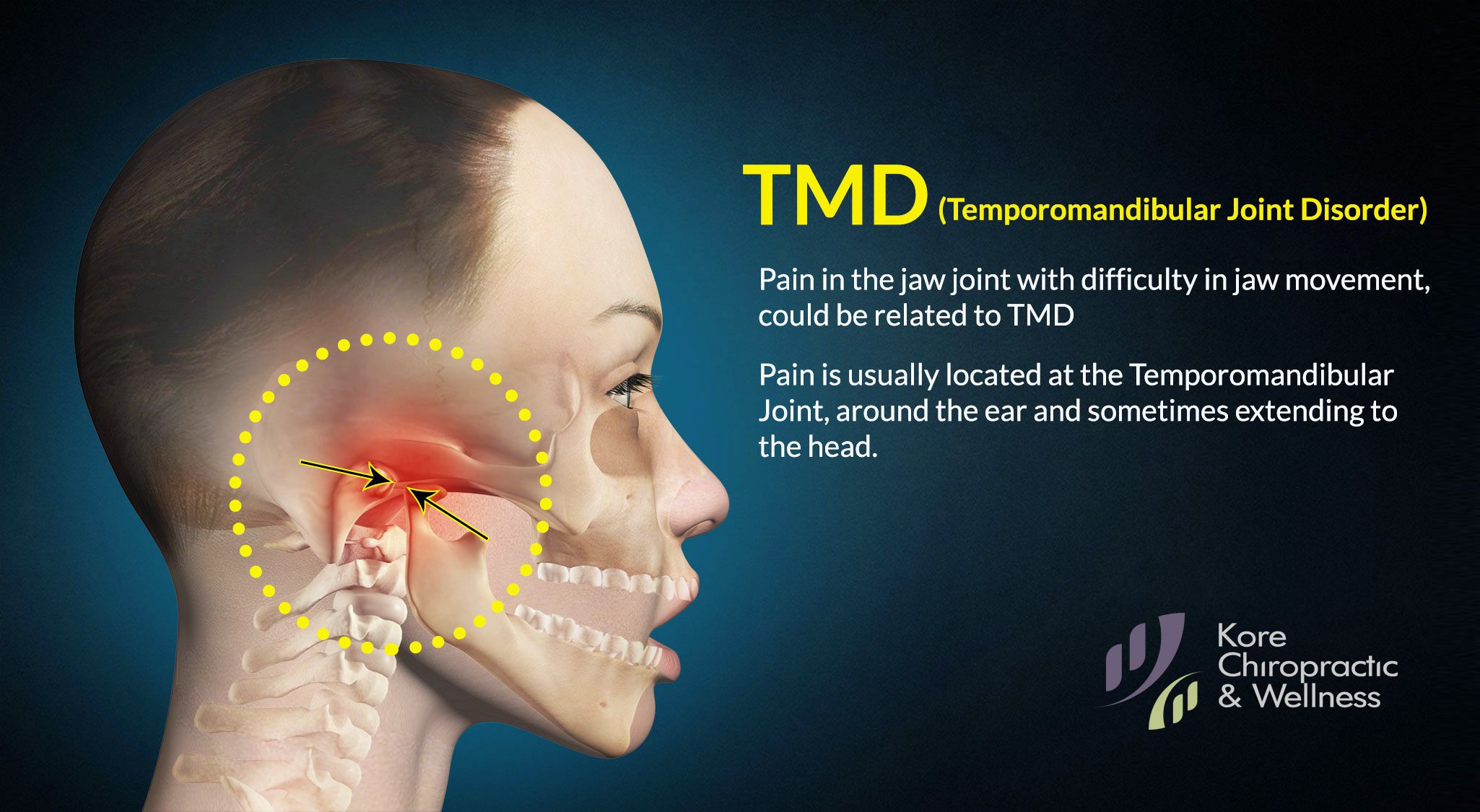 Pain In Jaw And Ear