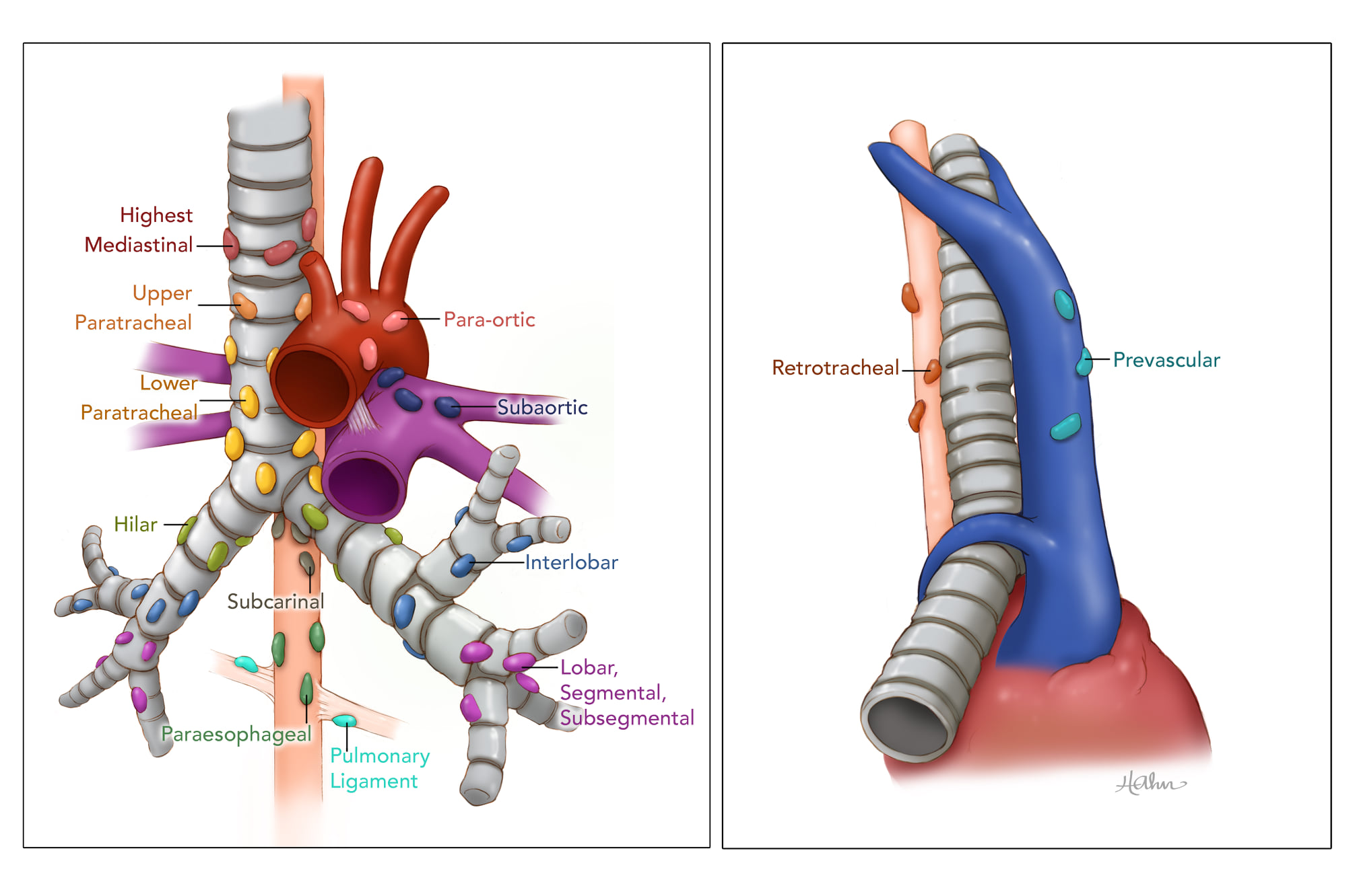 Paratracheal Lymph Node