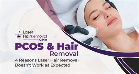 Pcos Hair Removal