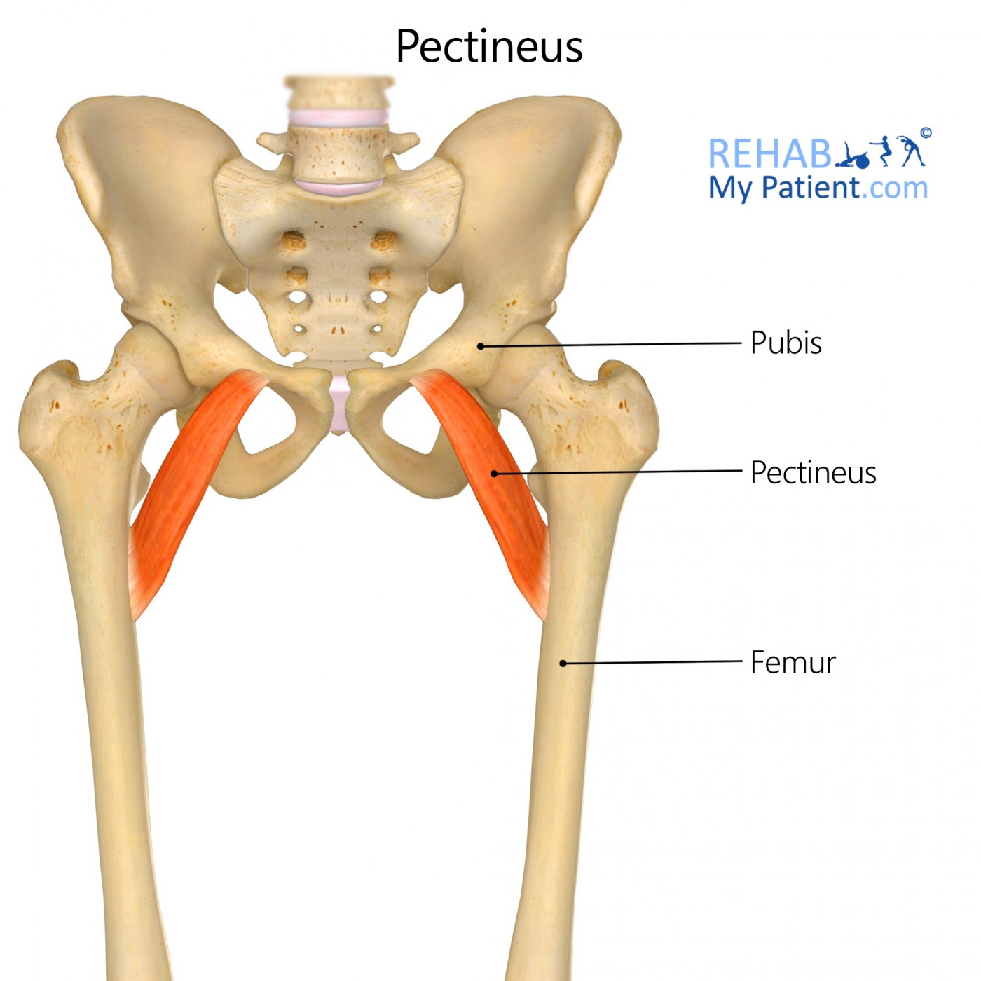 Pectineus Muscle Pain