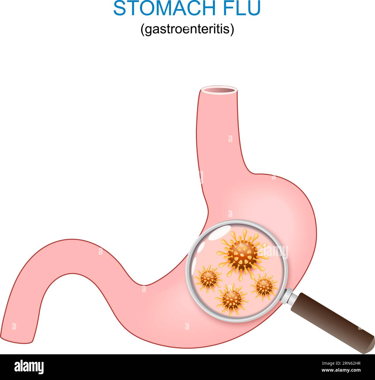 Pediatric Stomach Flu