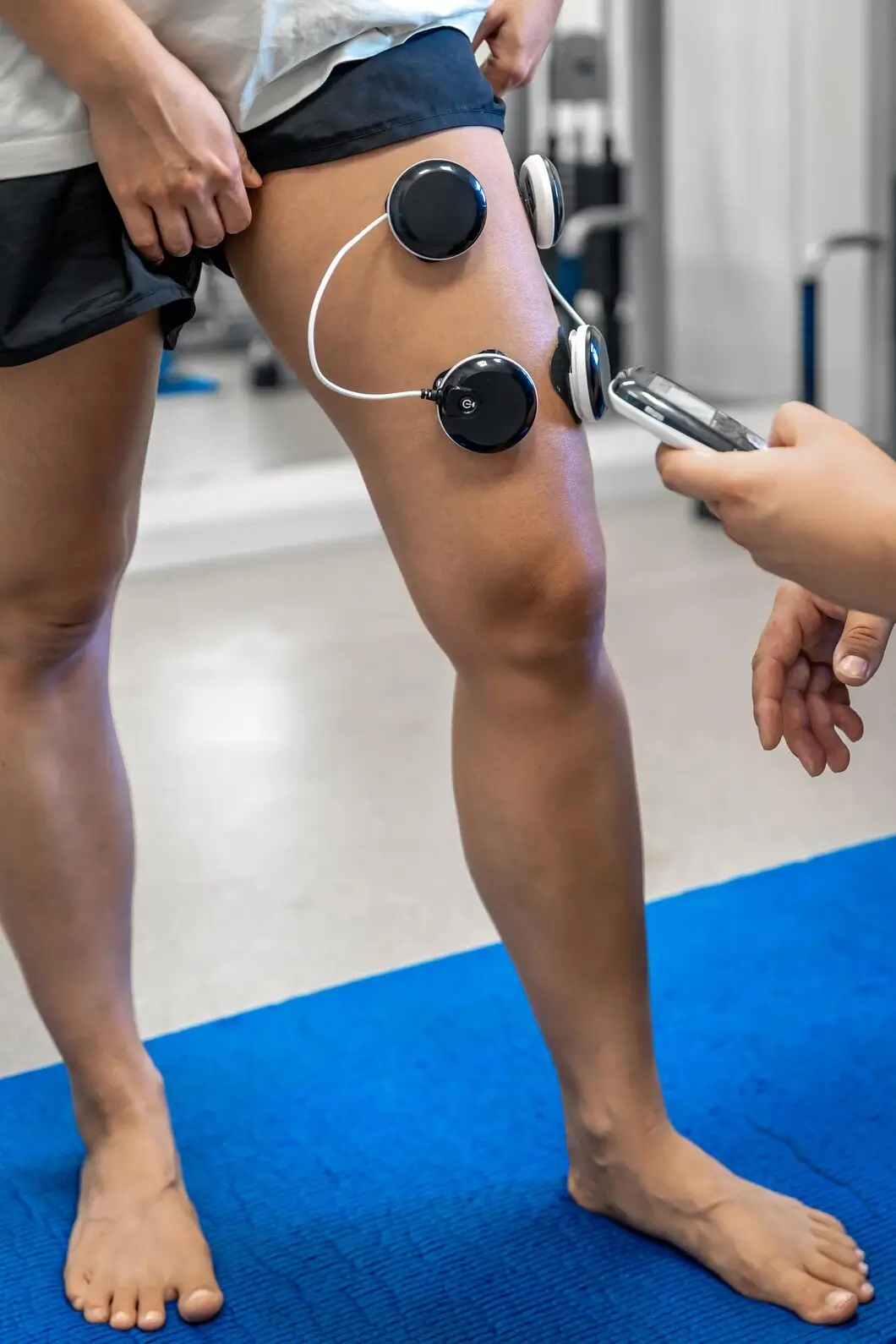 Peripheral Nerve Stimulation