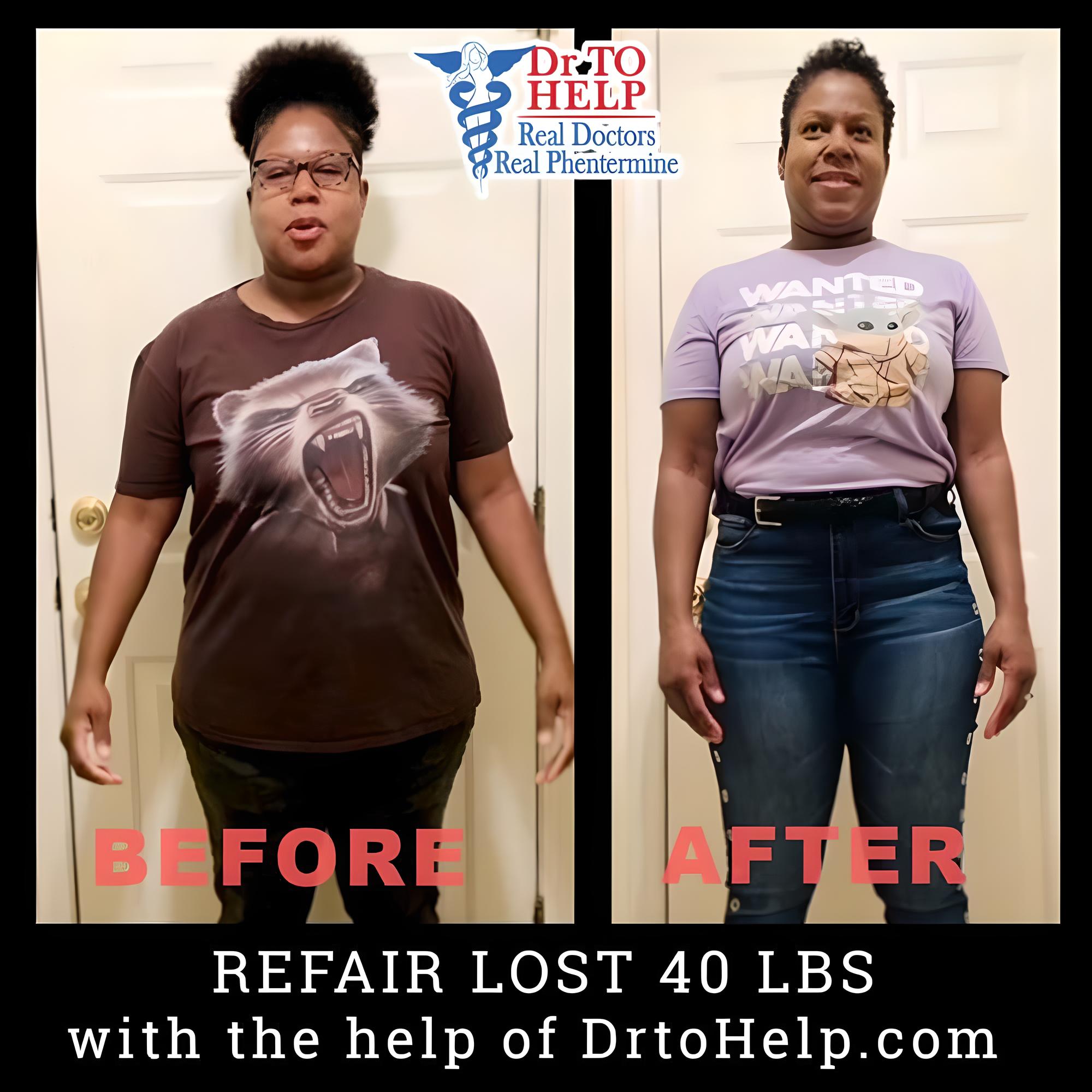 Phentermine Before And After