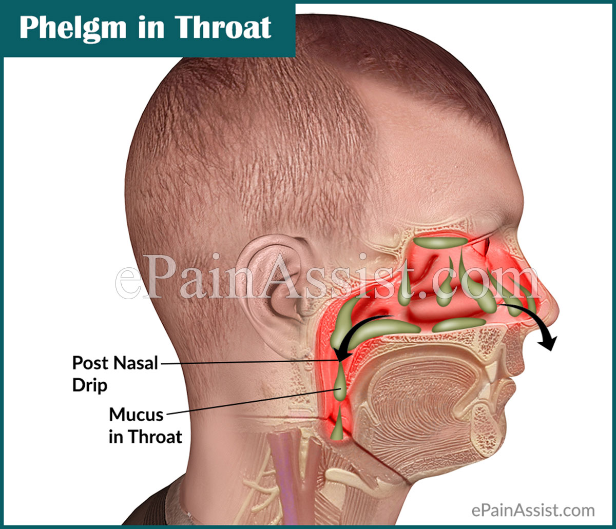 Phlegm At Throat